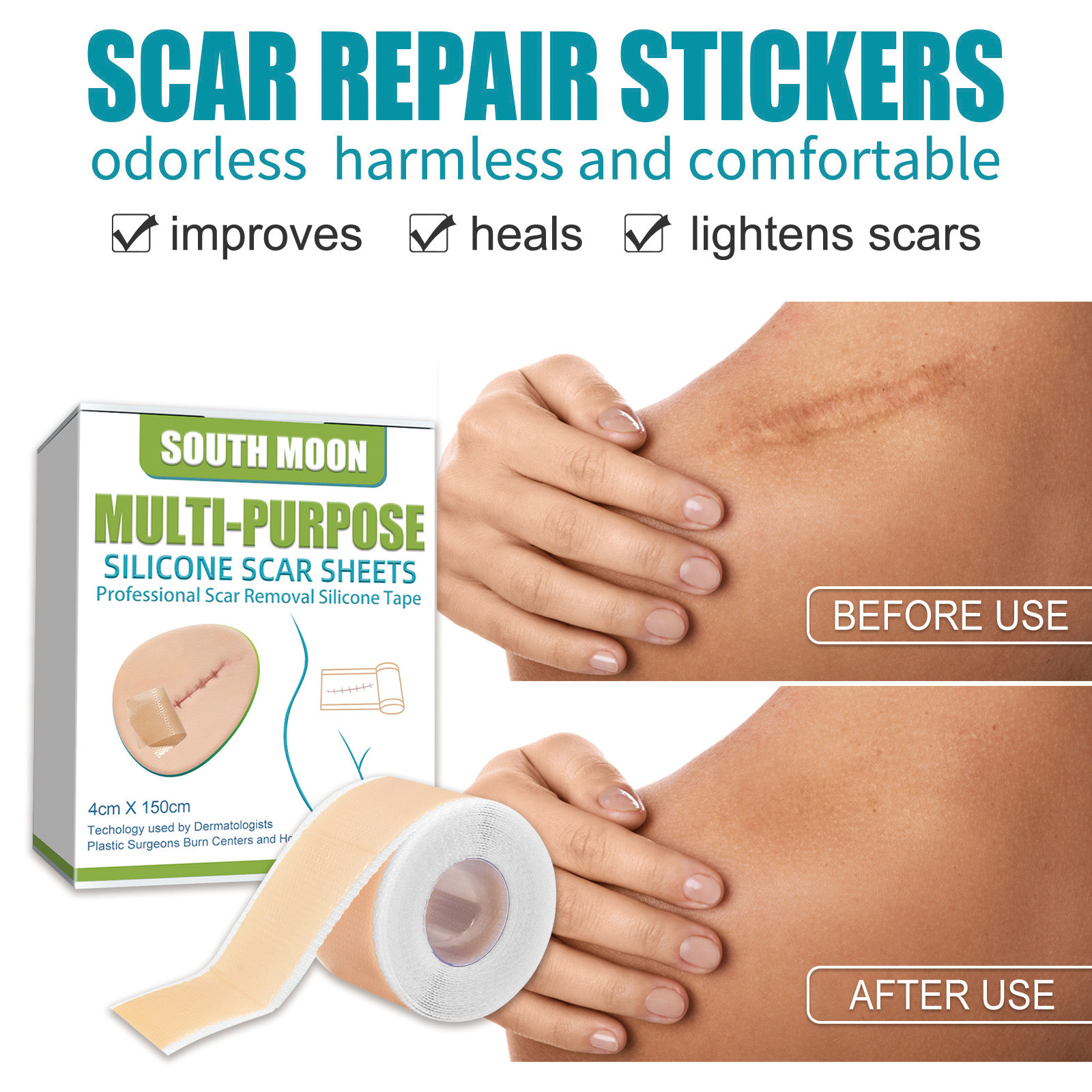 South Moon Silicone Scar Sheets Multi Purpose Self Adhesive Scar Cover Tape Removal Tape Acne Trauma Burn Scar Skin Repair Scar Patch Treatment Beauty Skin Care