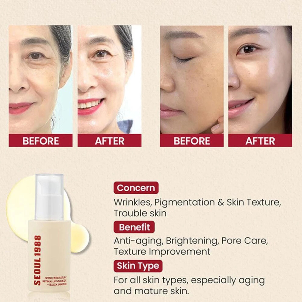 KSECRET SEOUL 1988 Serum Retinal Liposome 2 Percent Black Ginseng 30ml