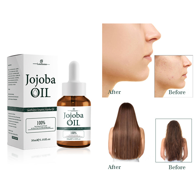 Jojoba Oil For Facial Moisturizing Nourishing And Skin Balancing Daily Massage And Care Oil 30ml