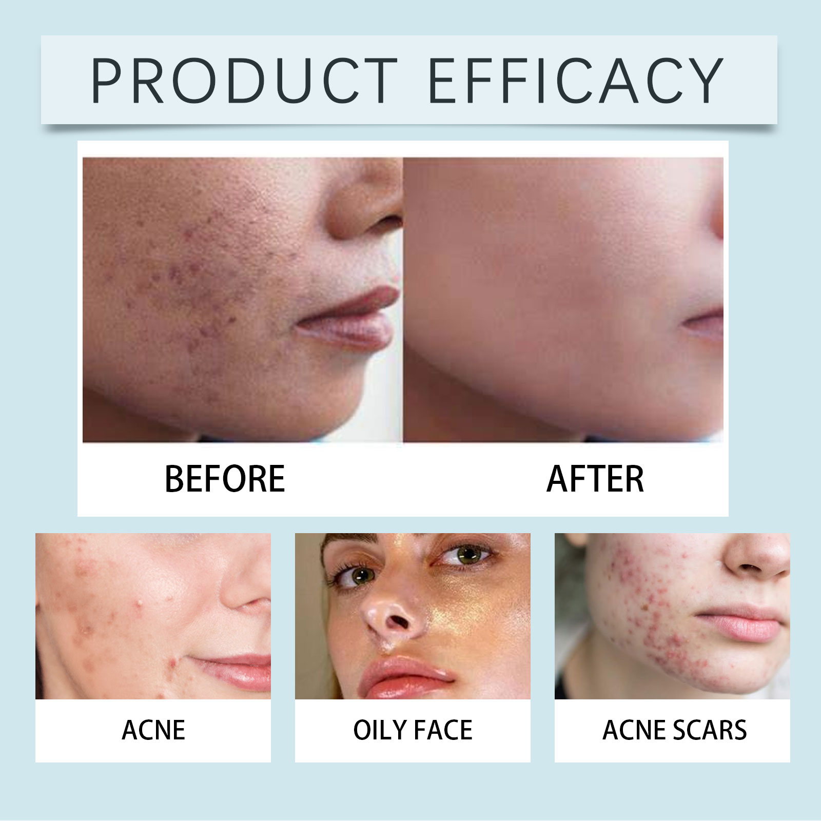 Skin Care Essence Liquid Soft Texture Mild Moisturizing Hydrating Nourishing Skin Refreshing Daily Facial Treatment