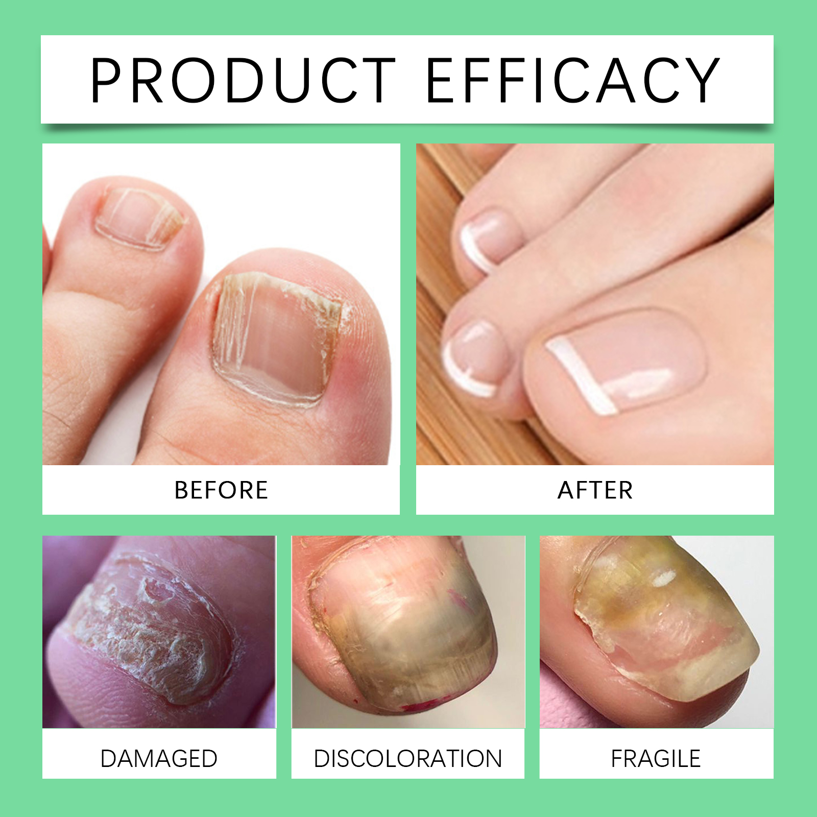 Nail Nourish Serum Mild Formula Protect Soft Natural Shiny Smooth Daily Maintain Hand Toe Nail
