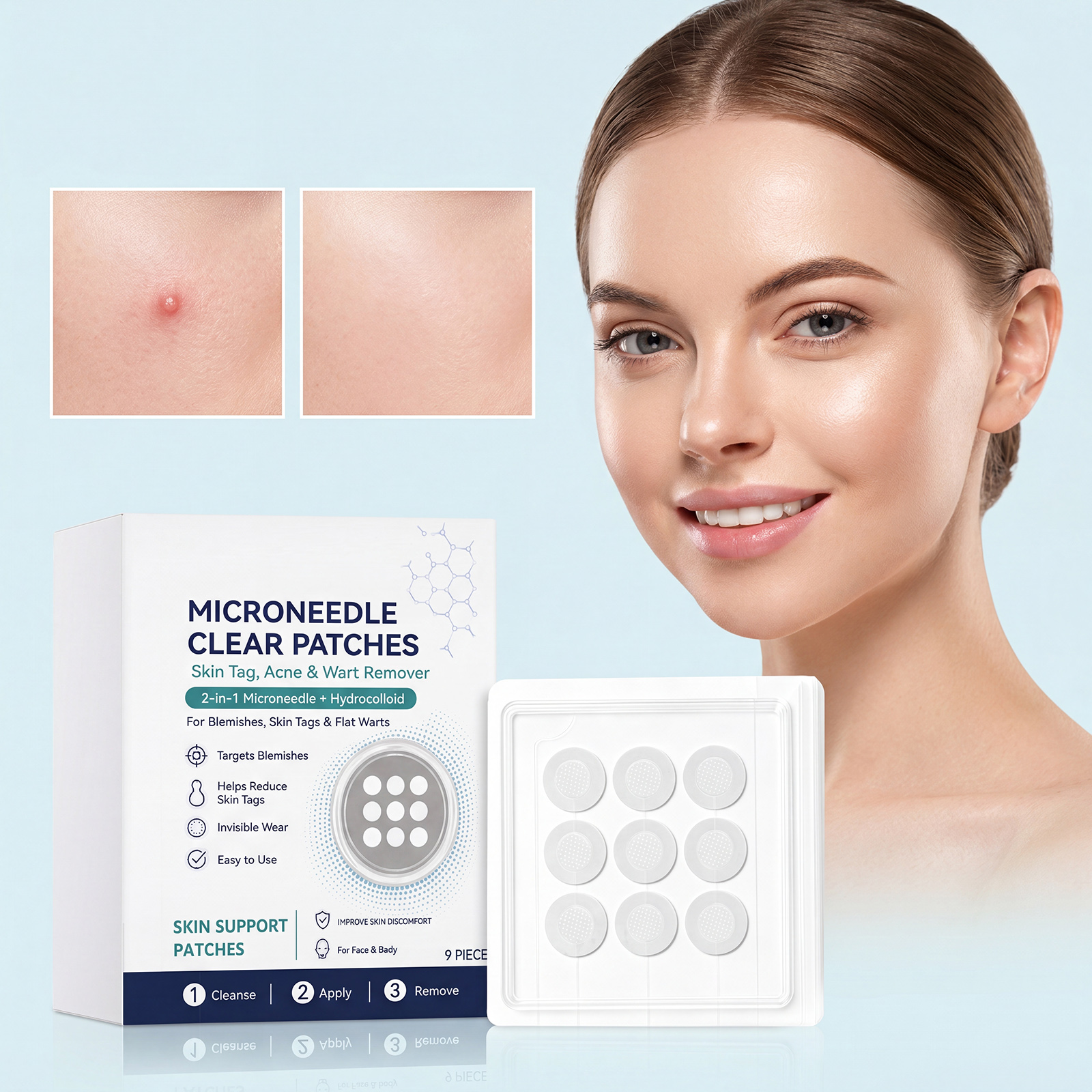 Acne Care Patch Mild Gentle Soothing Comfort Hydrating Refreshing Facial Blemish Skin Daily Treatment