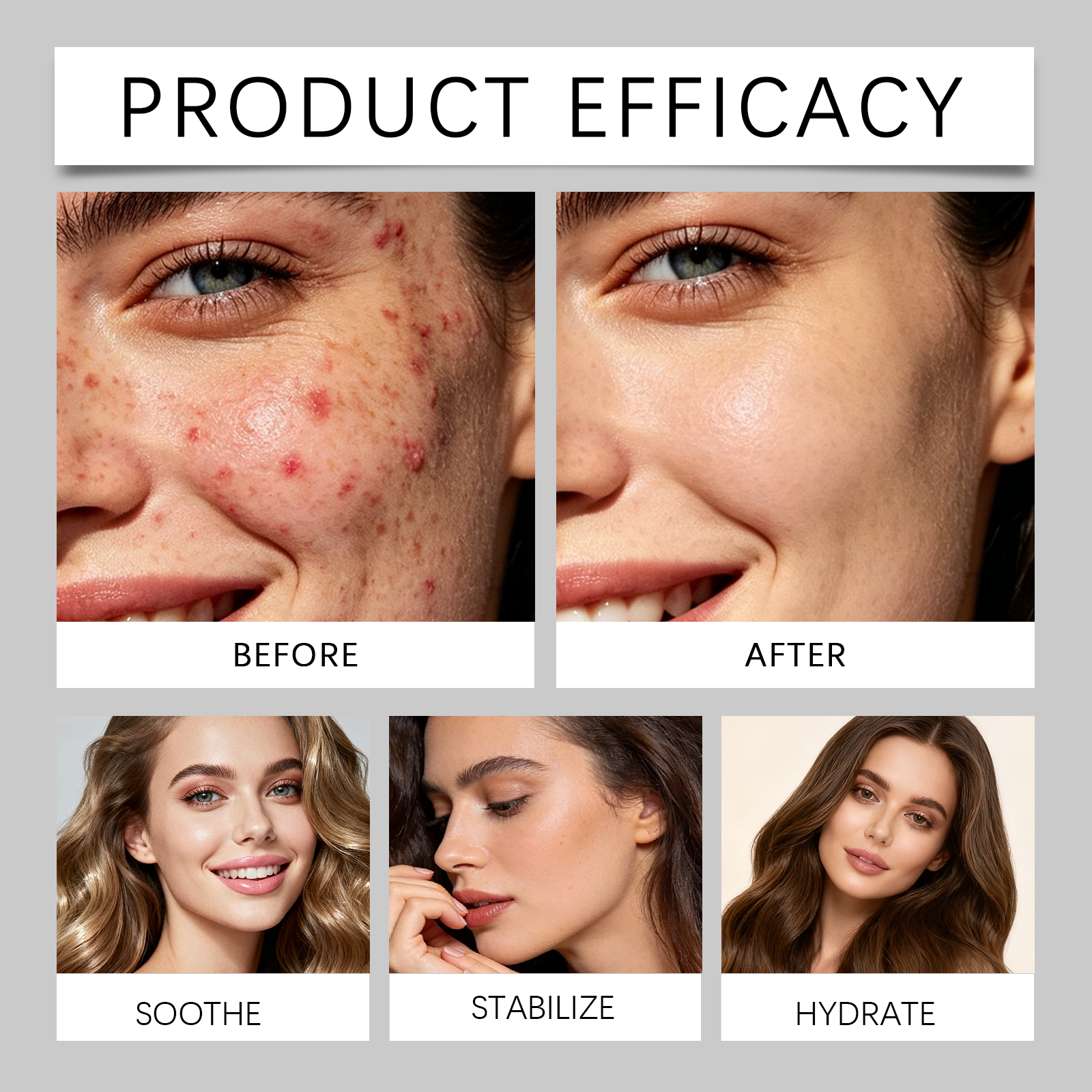Acne Care Patch Mild Gentle Soothing Comfort Hydrating Refreshing Facial Blemish Skin Daily Treatment
