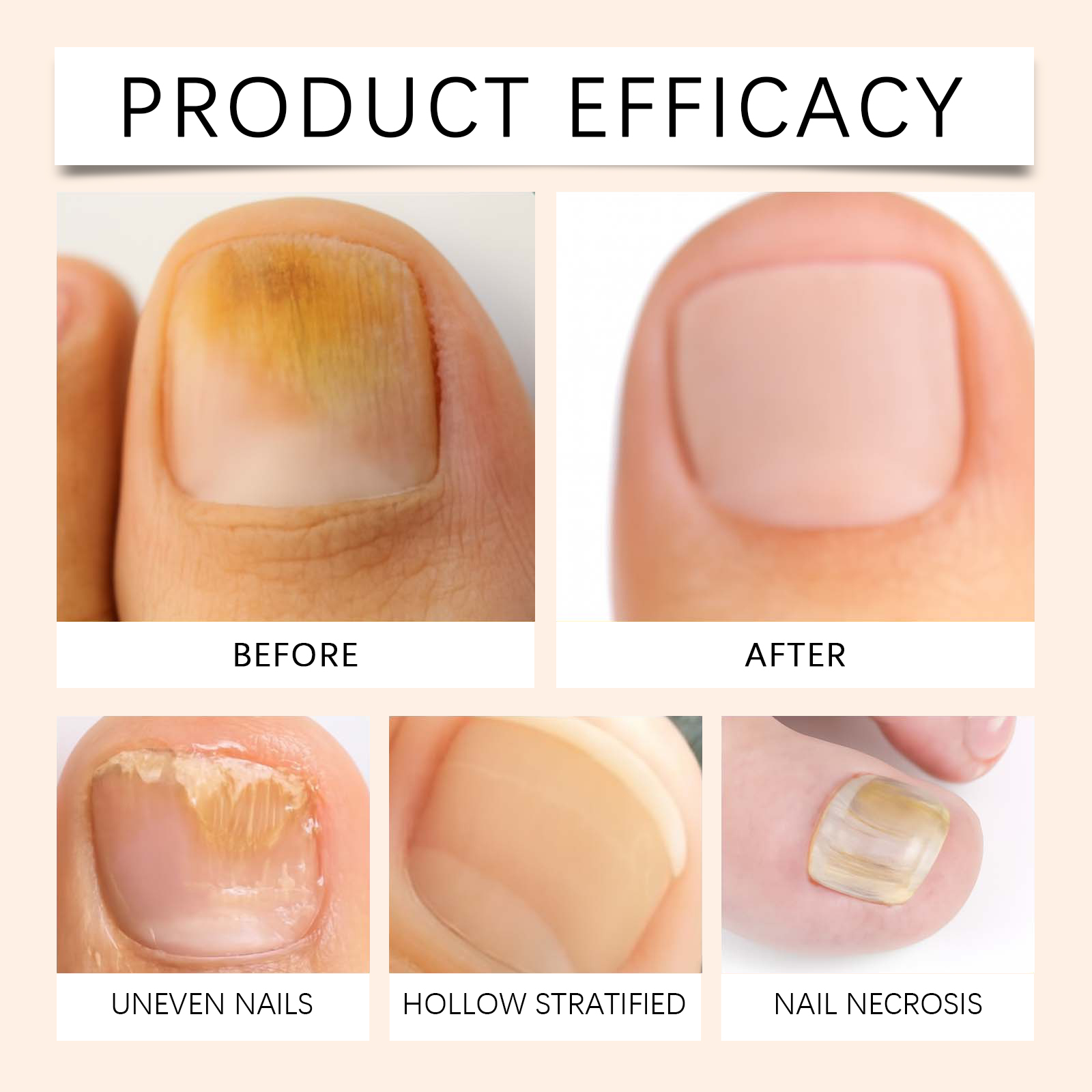 Nail Care Spray Daily Mild Nourishment Improve Nail Cuticle Cleansing Auxiliary Care Nails