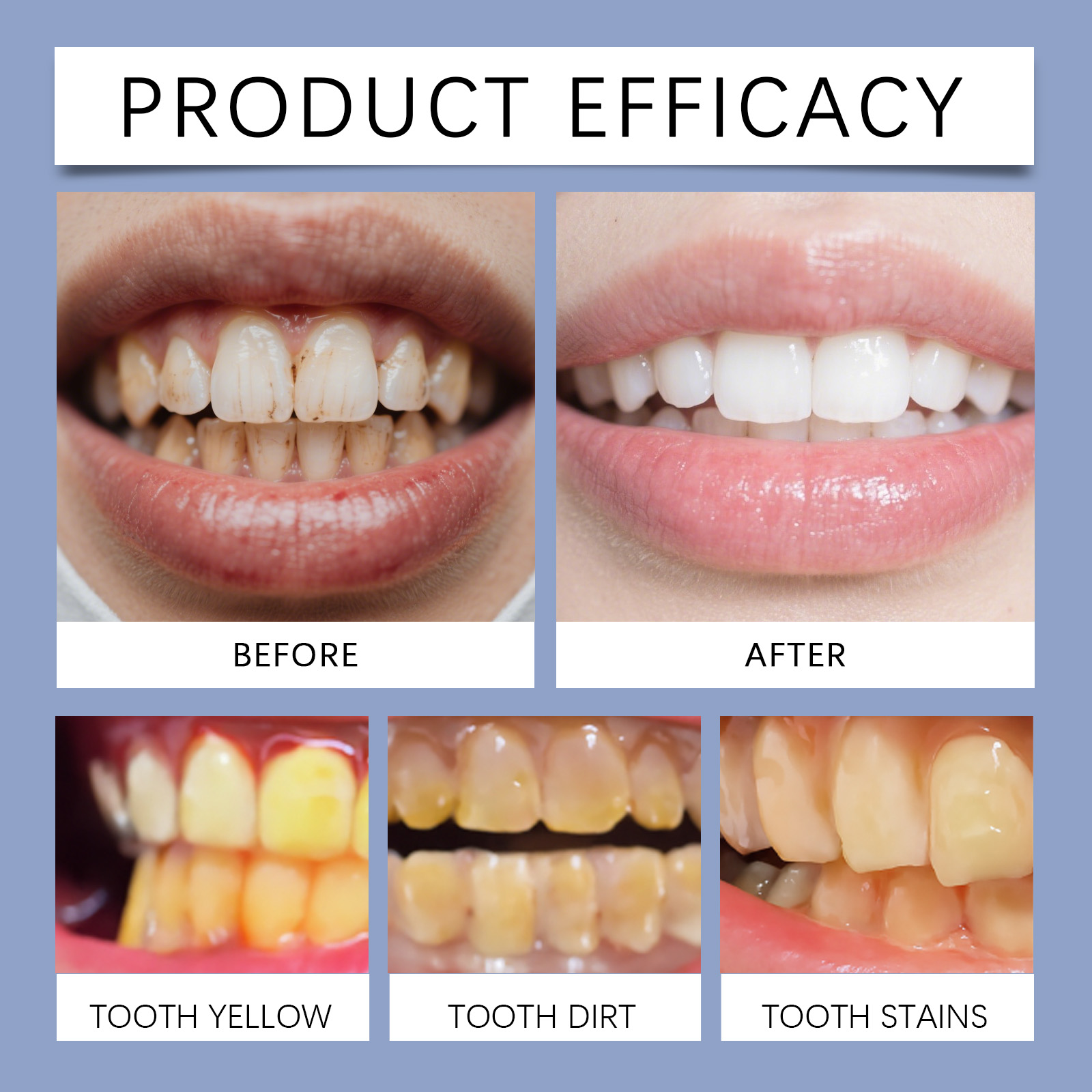 Dental Mousse Gentle Clean Yellow Teeth Tartar Protect Teeth Fresh Comfort Daily Oral Care