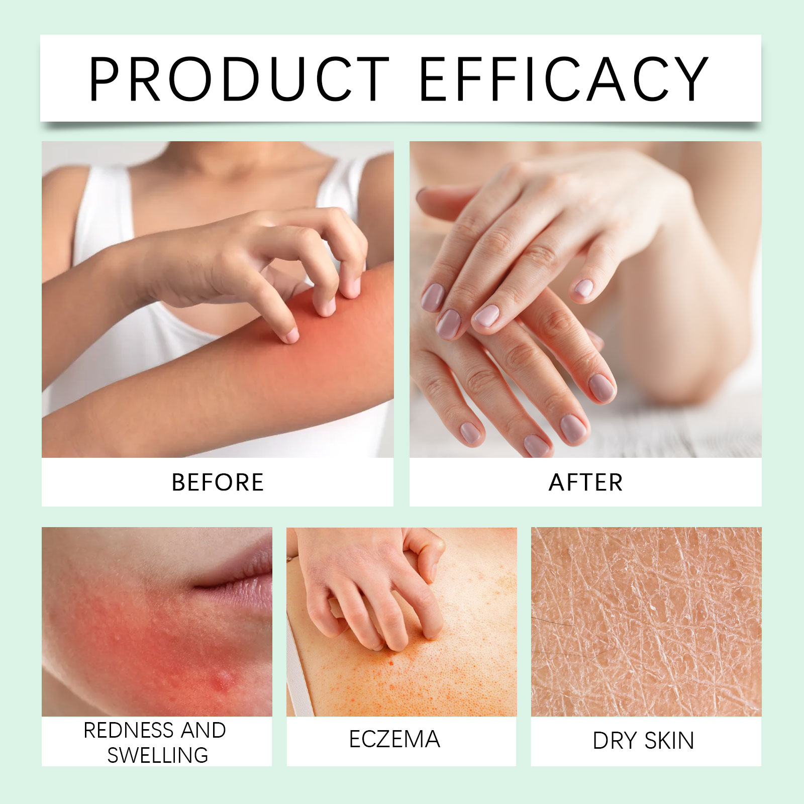 Hyaluronic Acid Body Essence Liquid Mild Nourish Elastic Smooth Skin Refreshing Texture Moisturizing Care