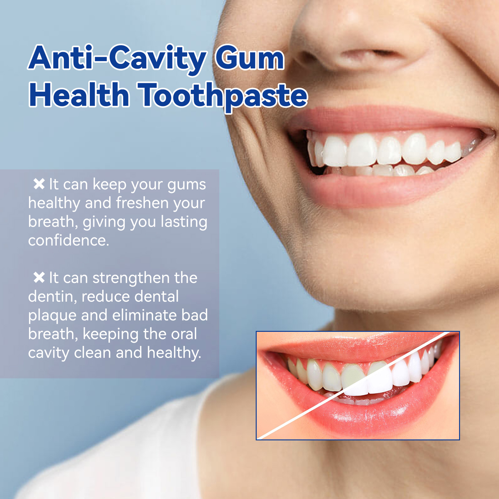 Anti Cavity Whitening Toothpaste Cleans Yellow Teeth Stains Plaque Freshens Breath Cleans And Protects Teeth