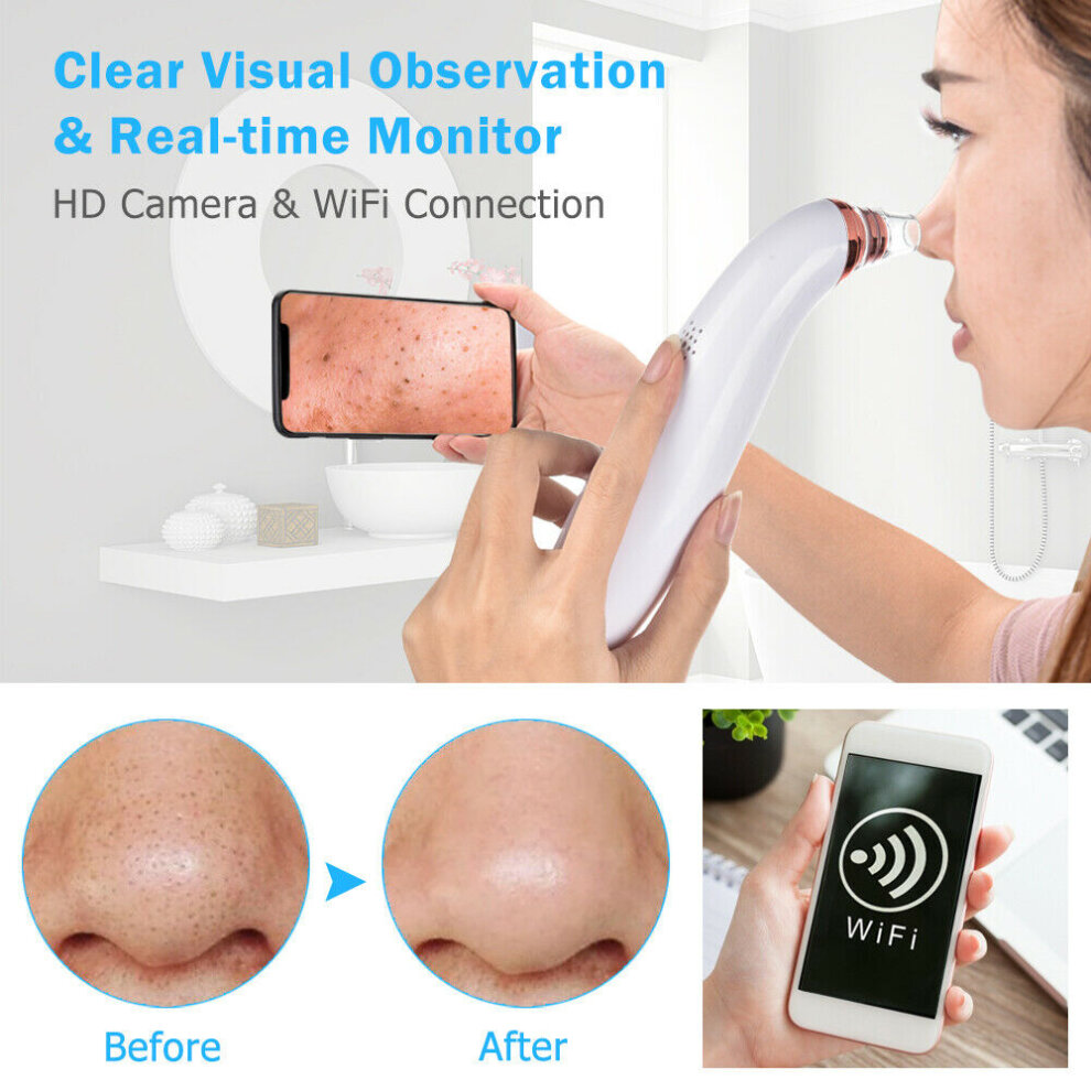 Blackhead Remover Wifi Cam Pore Vacuum Suction Face Nose Acne Cleaner