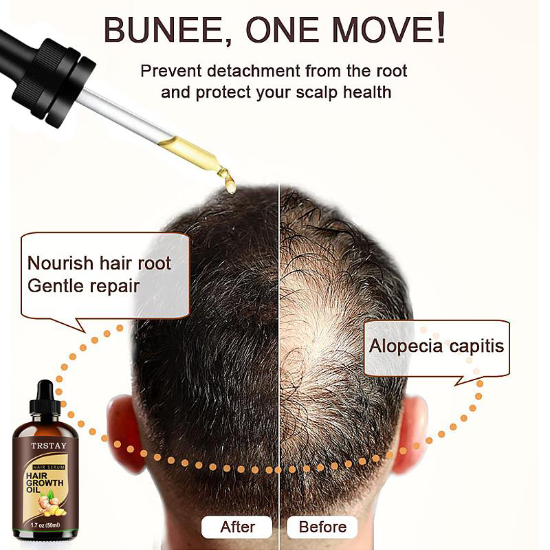 (15ml) Powerful Hair Growth Oil Prevent Hair Loss Products Essence Liquid Treatment For Men And Women Repair Shampoo Hair Care