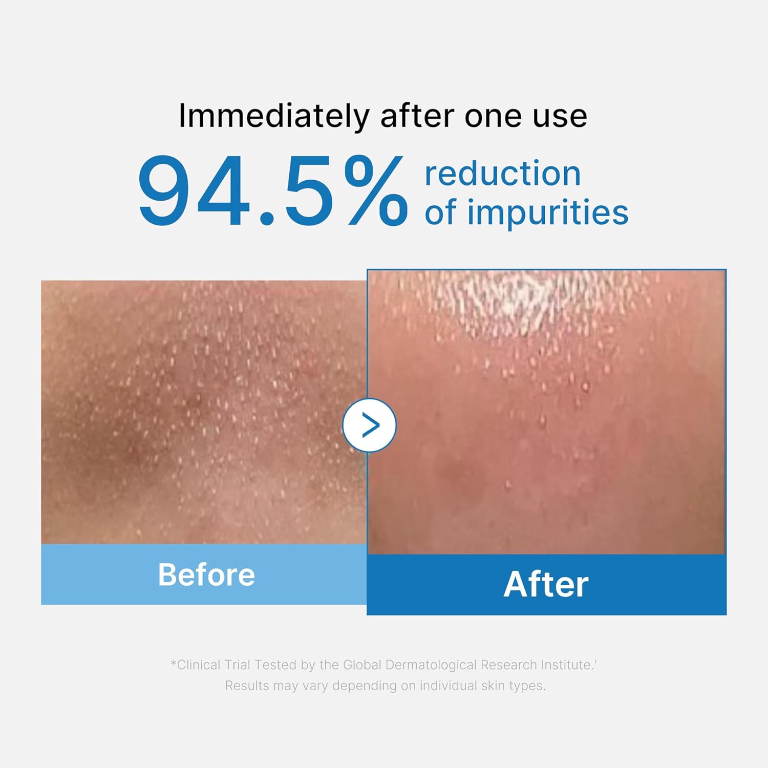 medicube Zero Pore Blackhead Cleansing Oil Makeup Remover for all skin types Daily Moisture Facial Cleanser Low-Irritation Korean Skin Care 205ml