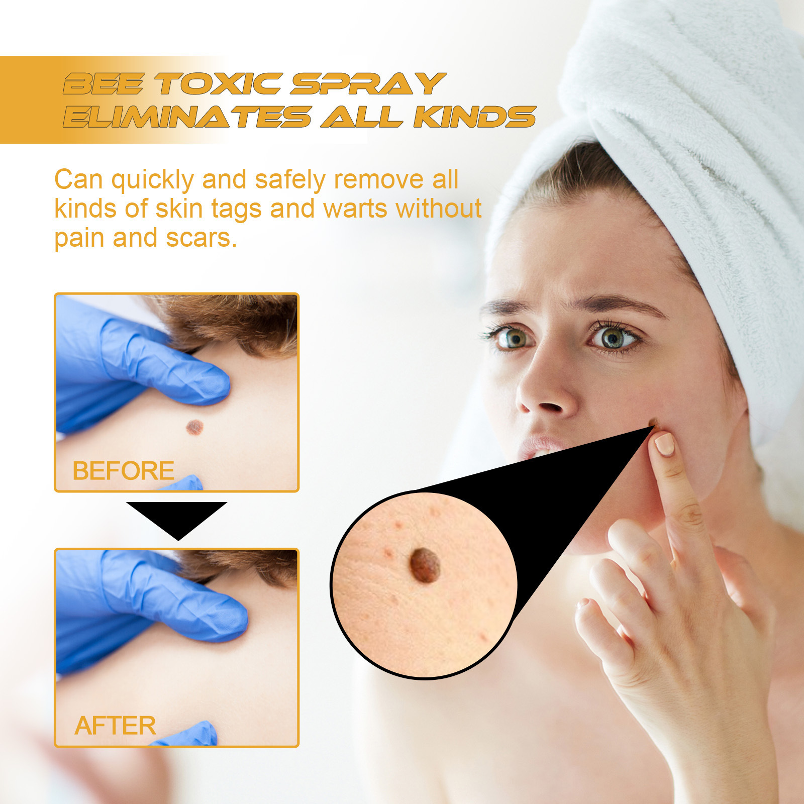Bee Venom Skin Tag And Blemish Care Spray For Smoothing Moisturizing And Daily Skin Nourishment