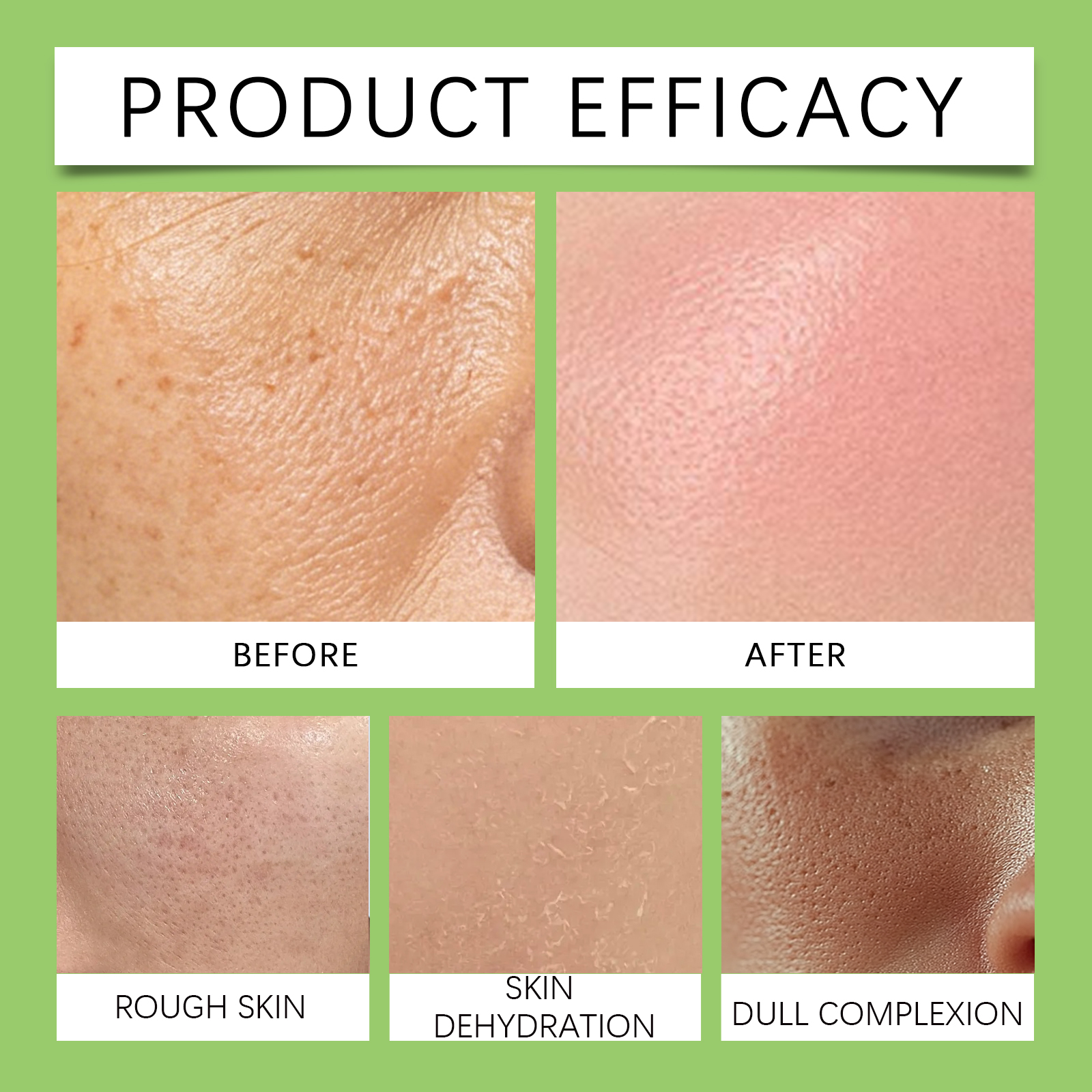 Facial Centella Essence Refreshing Nonsticky Hydrating Soft Light Moisturizing Skin Care