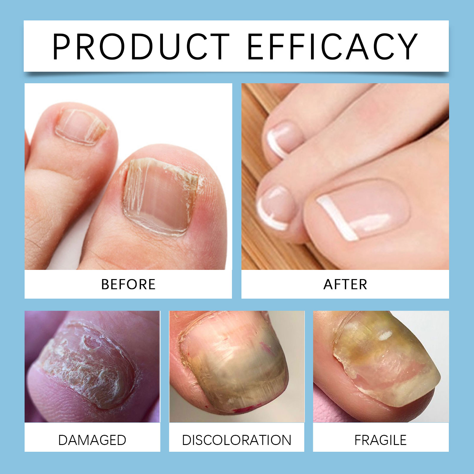 Nail Care Essence Mild Nourish Soften Cuticle Hydrating Strengthen Shine Fingernail Toenail Protect