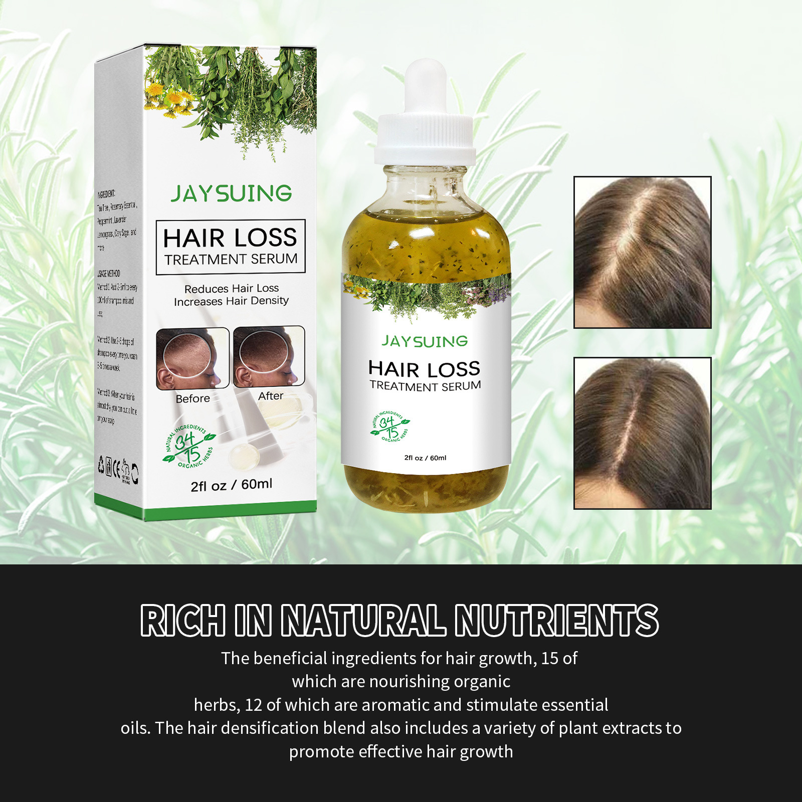 Hair Nourishing Treatment Strengthening Serum  Anti Hair Loss Essence Scalp Care Hair Treatment Oil for All Hair Types 60ml