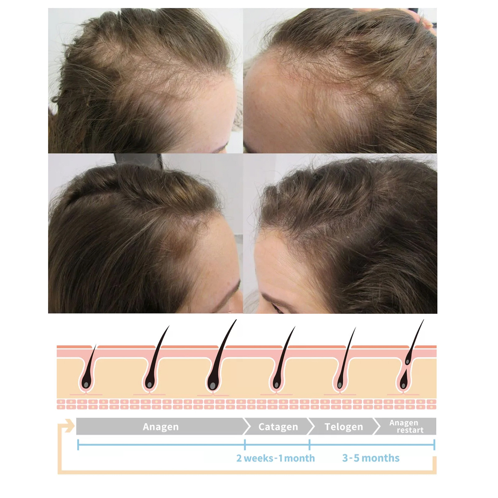Ginger Hair Growth Spray Scalp Massage Hair Care Nutrient Solution 30ml
