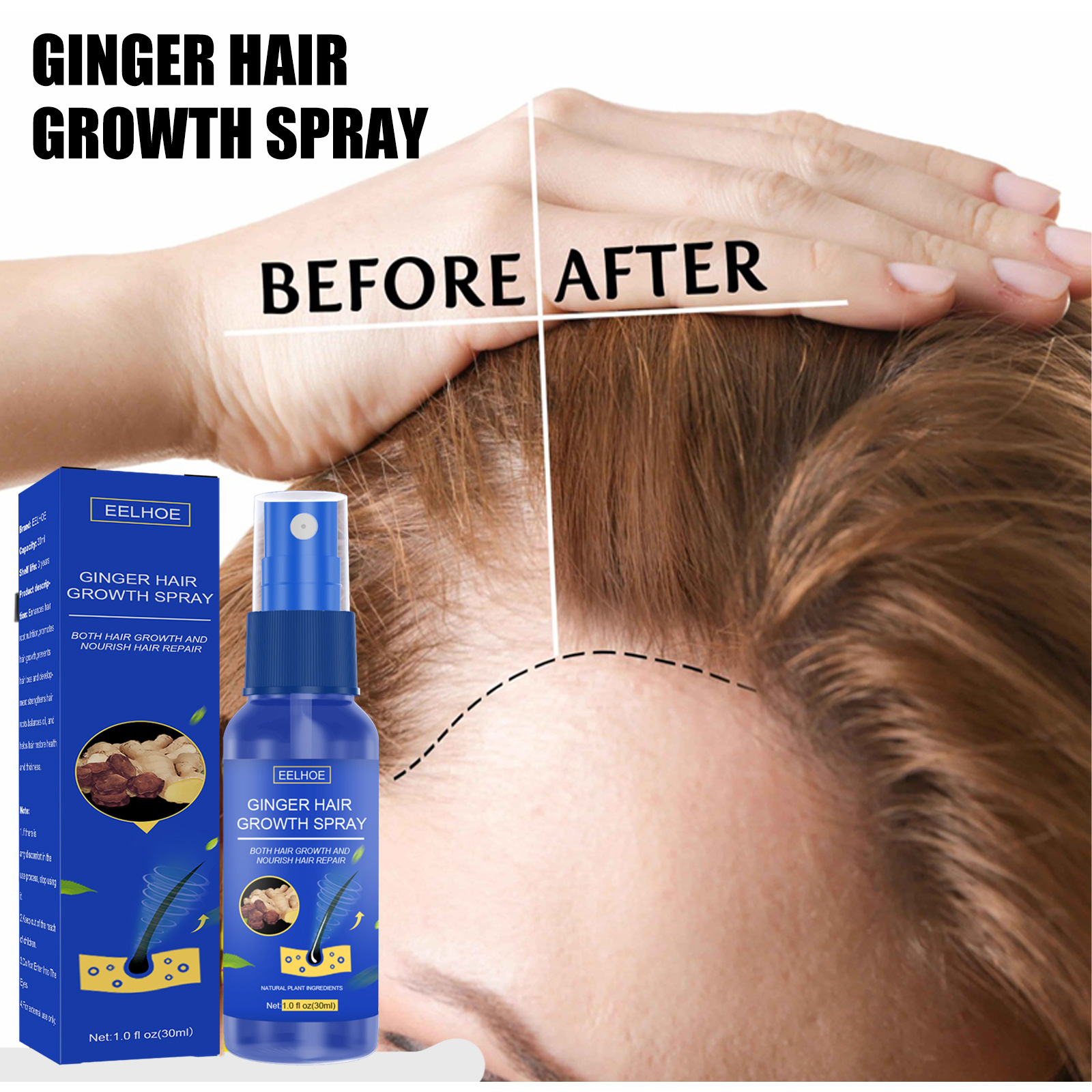 Ginger Hair Growth Spray Scalp Massage Hair Care Nutrient Solution 30ml
