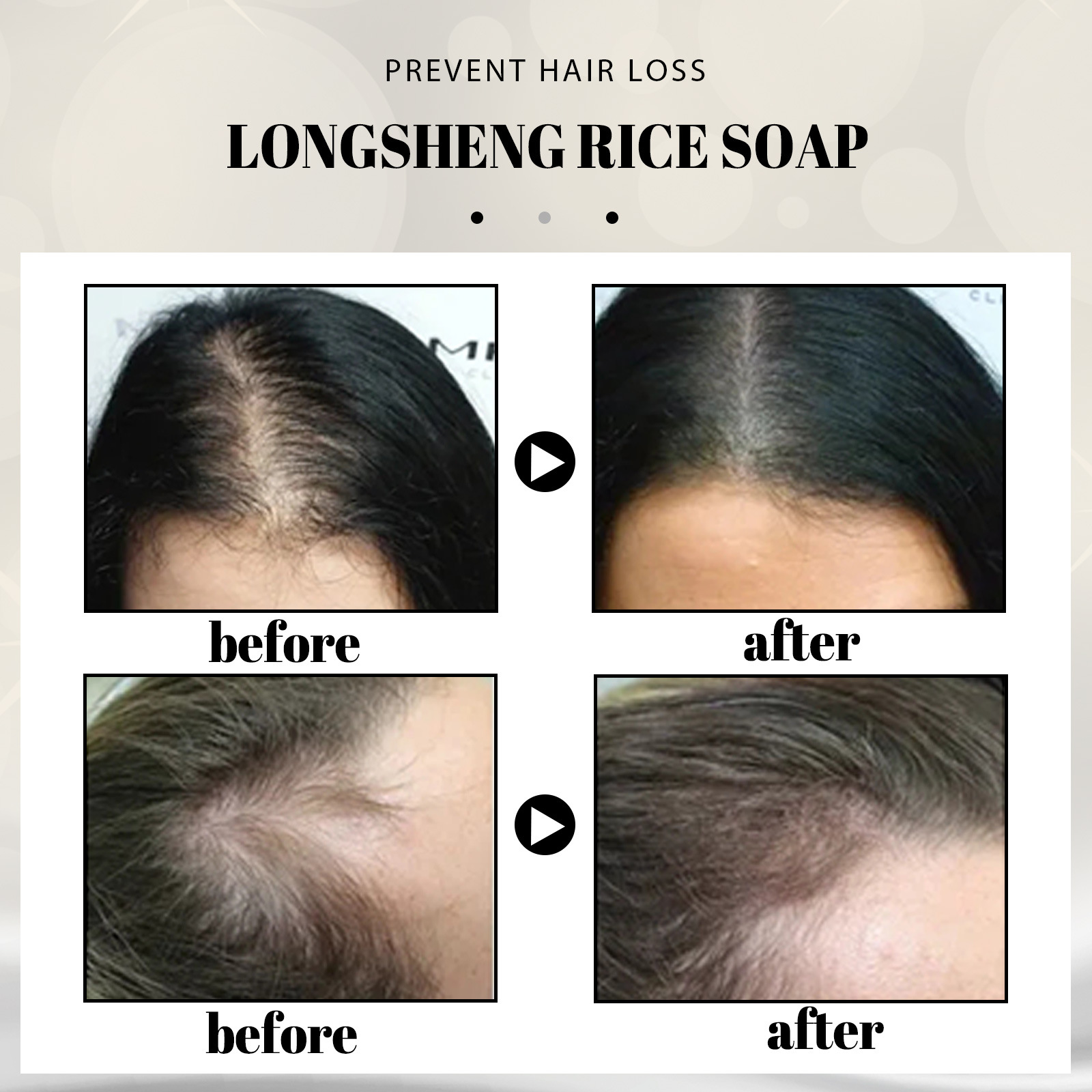 Rice Water Shampoo Soap Solid Hair Growth Shampoo Bar Hair Moisturizing Anti Hair Loss Treatments