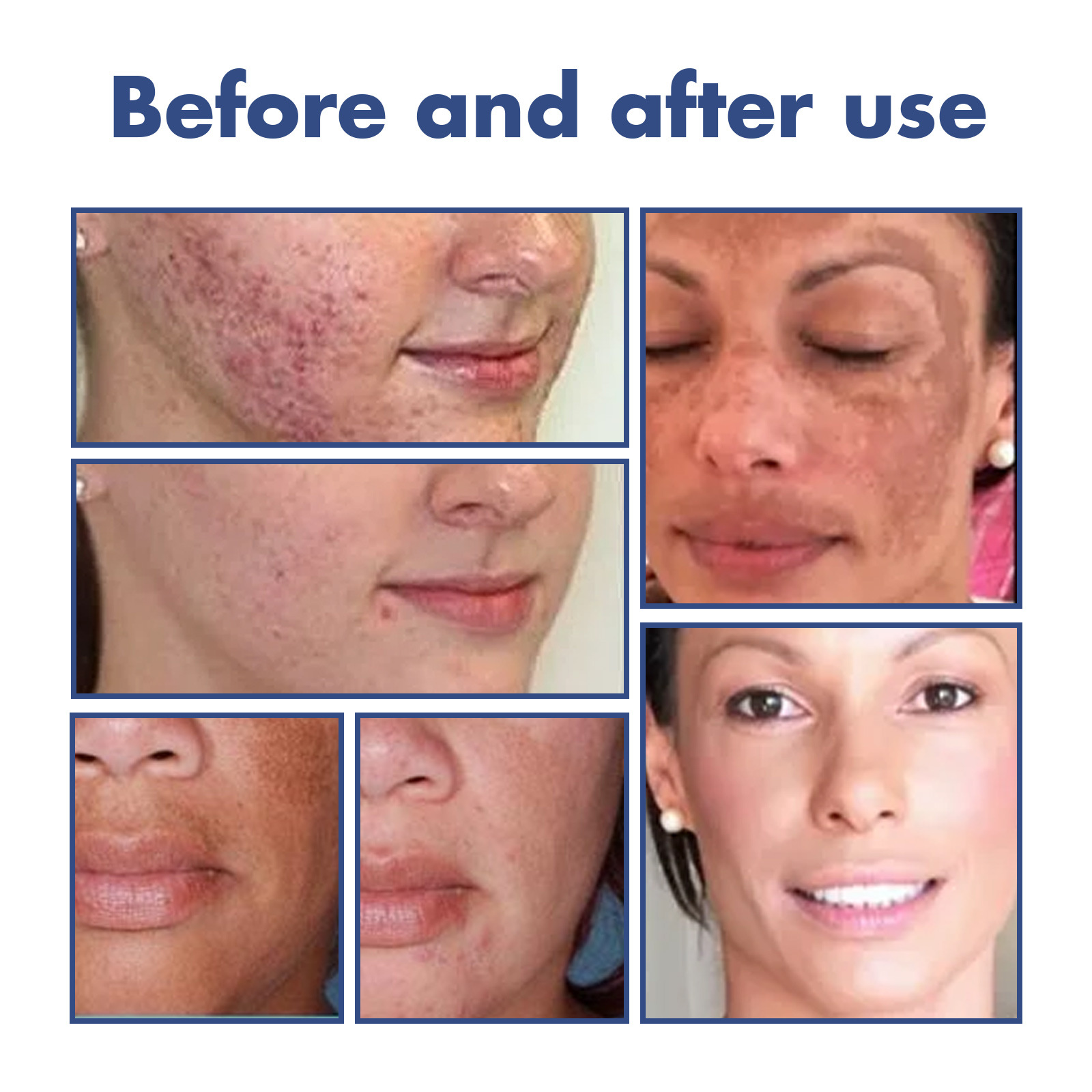 Cleansing Lotion Whitening Face Cleanser Oil Control Cleanser Acne Spots Deep Cleaning Reducing Pores Moisturizing Facial Repair Brightening Skin Tone