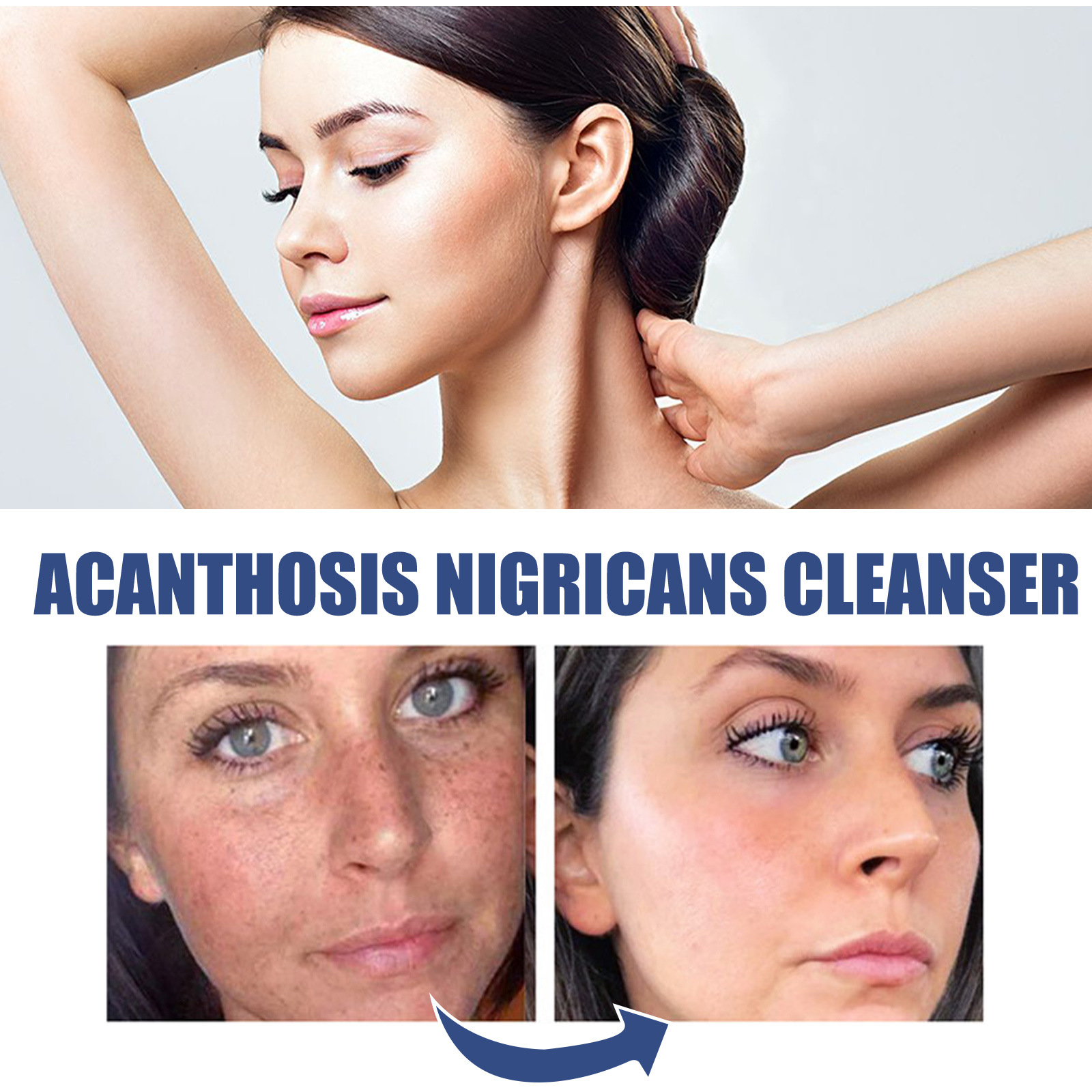 Cleansing Lotion Whitening Face Cleanser Oil Control Cleanser Acne Spots Deep Cleaning Reducing Pores Moisturizing Facial Repair Brightening Skin Tone