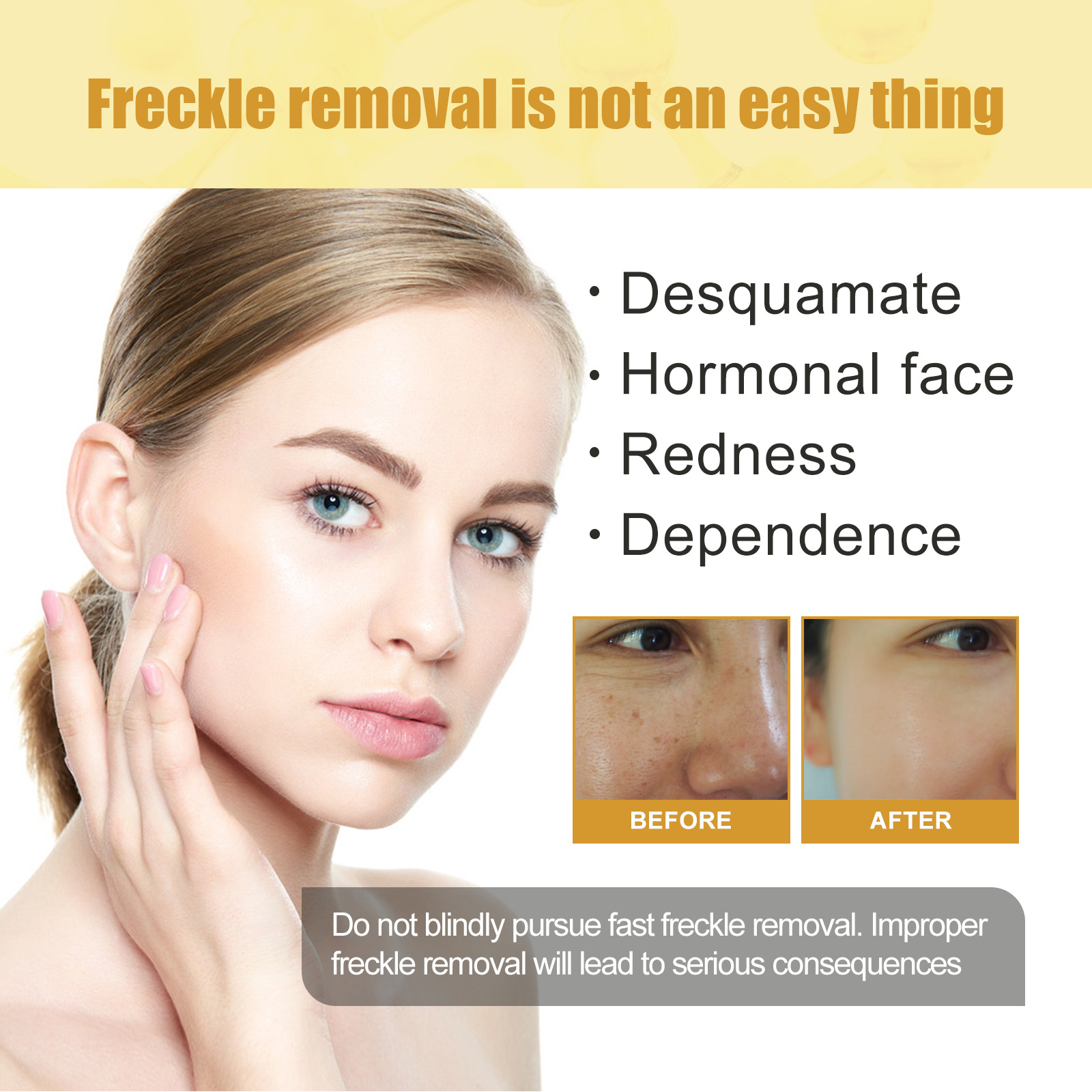 Brightening Face Cream Freckl-e Removal Lightening Dullness Fade D-ark S-pot C-hloasma Skin Firming Moisturizing M-elasma Cream