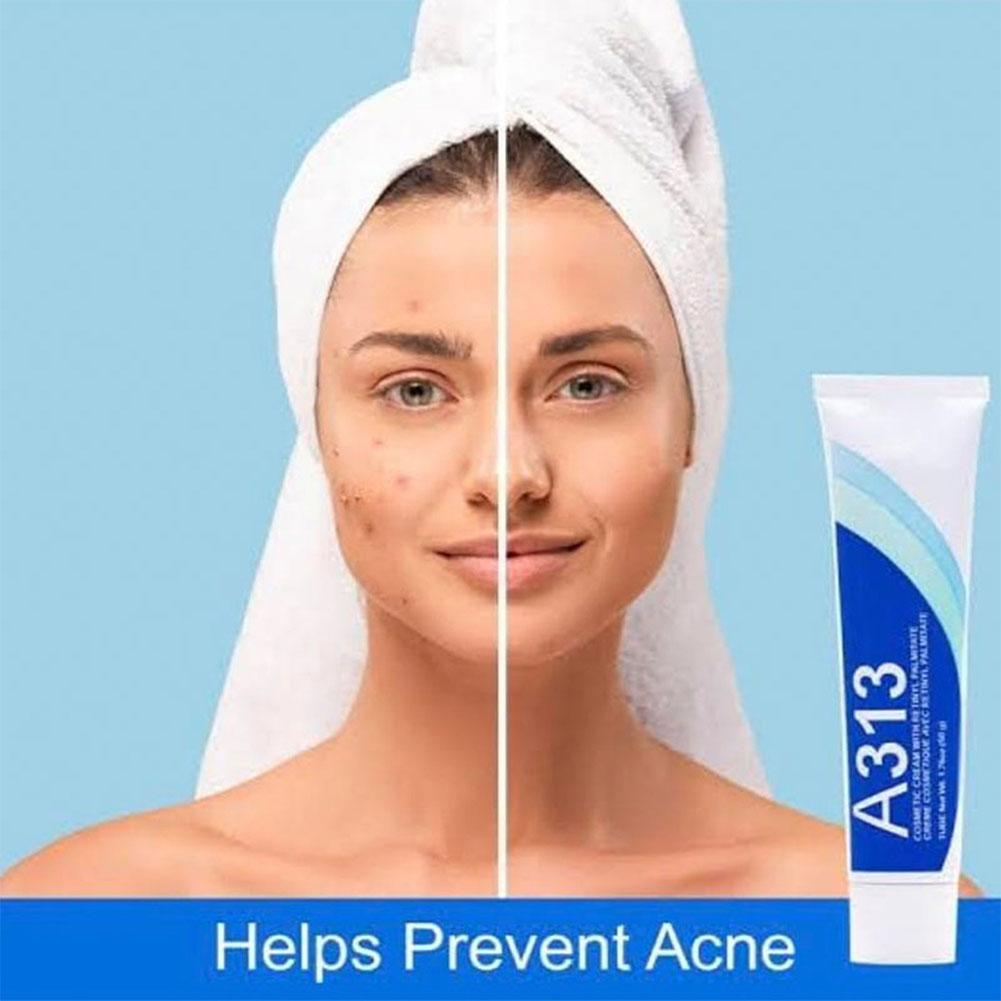 BARUBT Night Mousturizer Retinol Vitamin A Cream A313 Facial Cream Anti Aging Deeply Tightens Lifts Moistens Hydrates Skin Care 50g