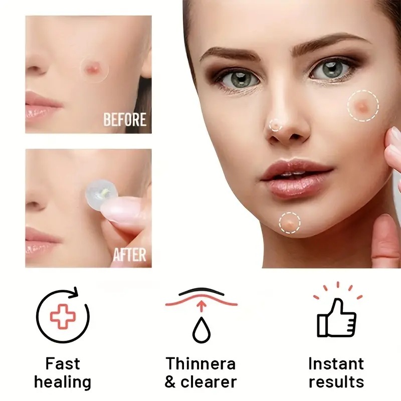 Hydrocolloid Acne Patches Cover Zits Blemishes Anti Pimple Invisible Healing Spot Stickers Waterproof Breathable Patches Women Men Face Skin Care