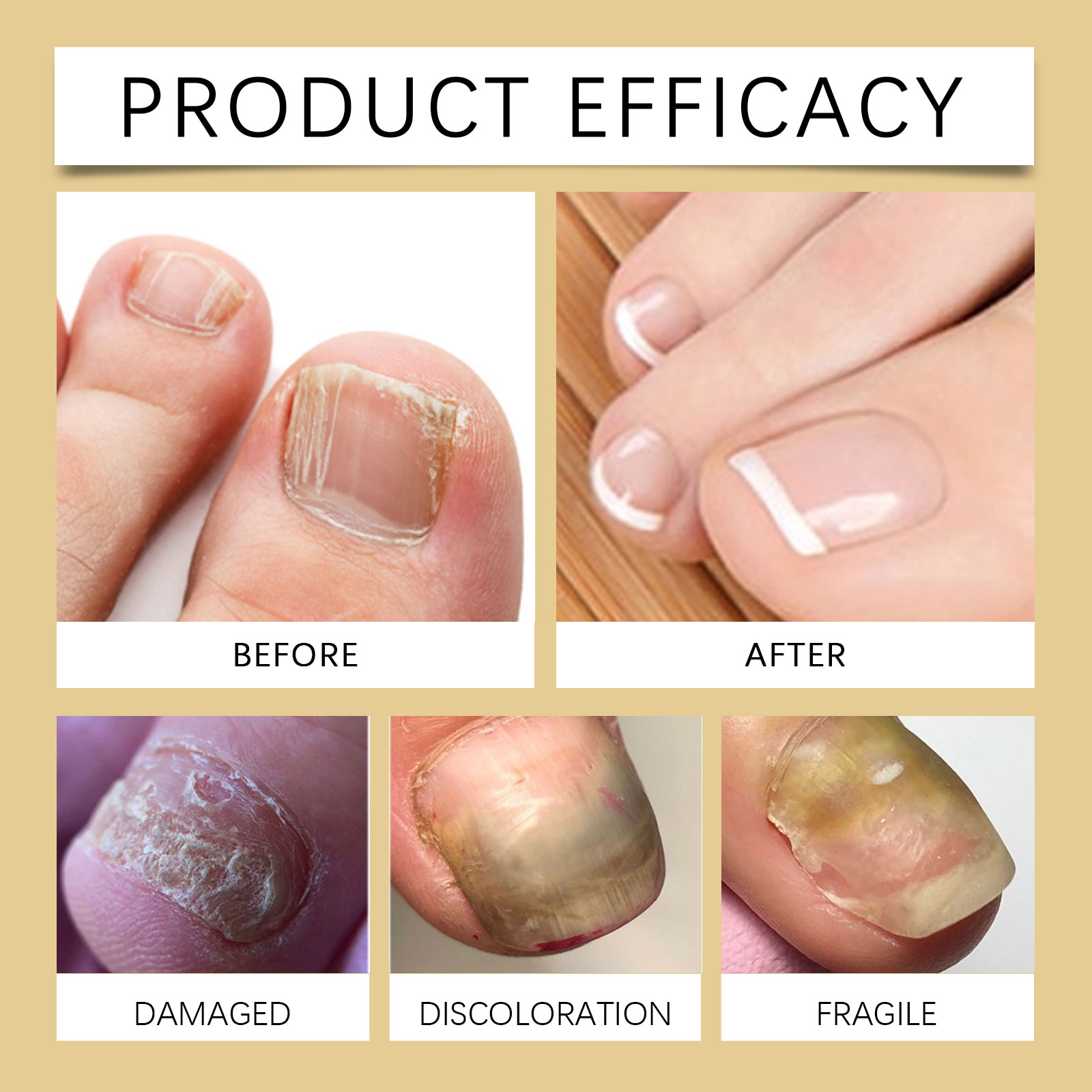 Nourishing Nail Care Oil Mild Ingredient Moisturizing Glossy Hand Foot Nail Smooth Nail Surface Care Essence Liquid