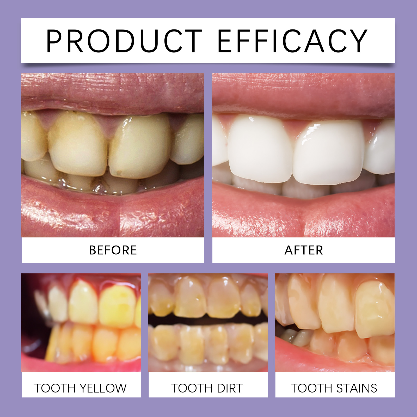 Purple Brightening Care Dental Strips For Daily Oral Teeth Surface Whitening Home Treatment