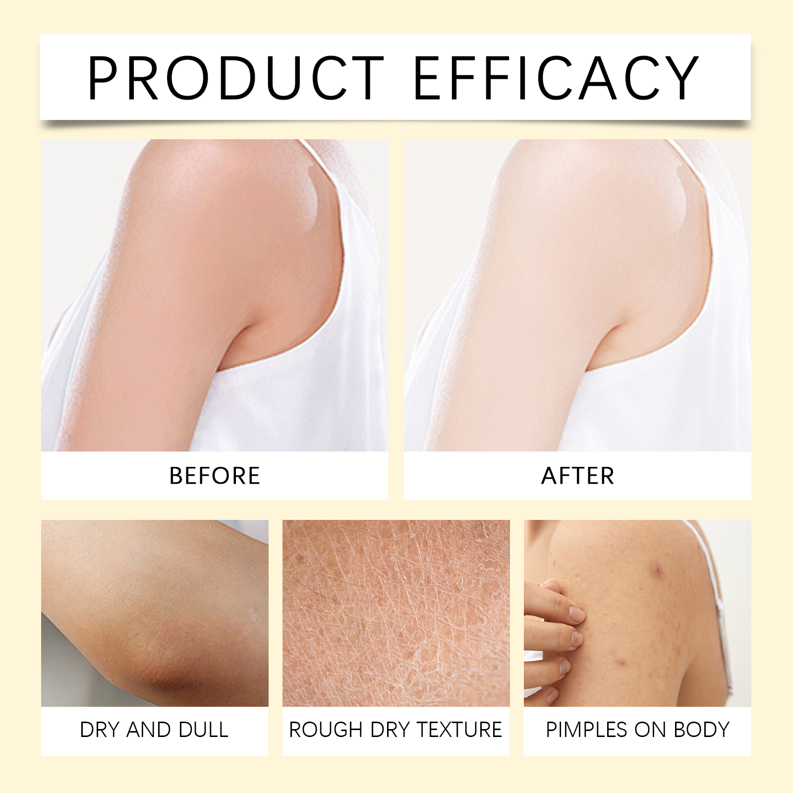 Bee Venom Skin Moisturizing Cream Gentle Hydrating Smooth Delicate Nourish Skin Daily Care Cream