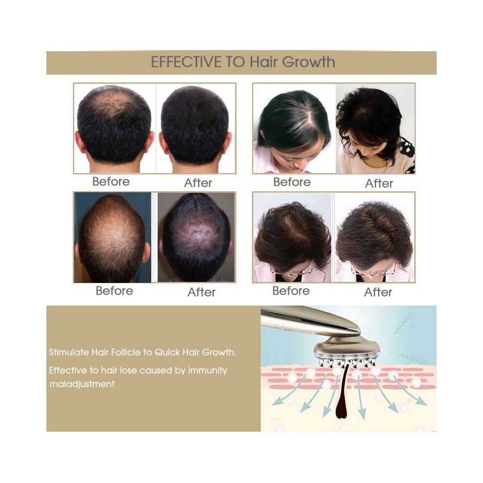 Laser Hair Growth Massage Comb Anti Hair Loss Massager EMS Vibration Massager Brushes Hair Regrowth Comb