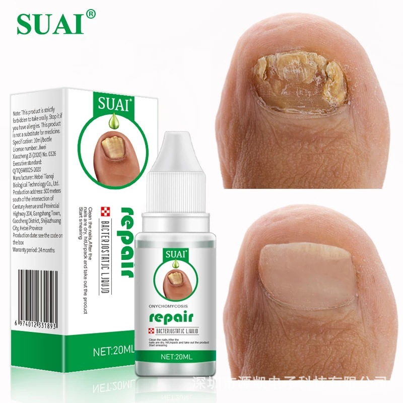 SUAI Nail Fungus Treatment Repair Liquid Foot Essence Serum Feet Care Products Anti Infection Onychomycosis Paronychia 20ml