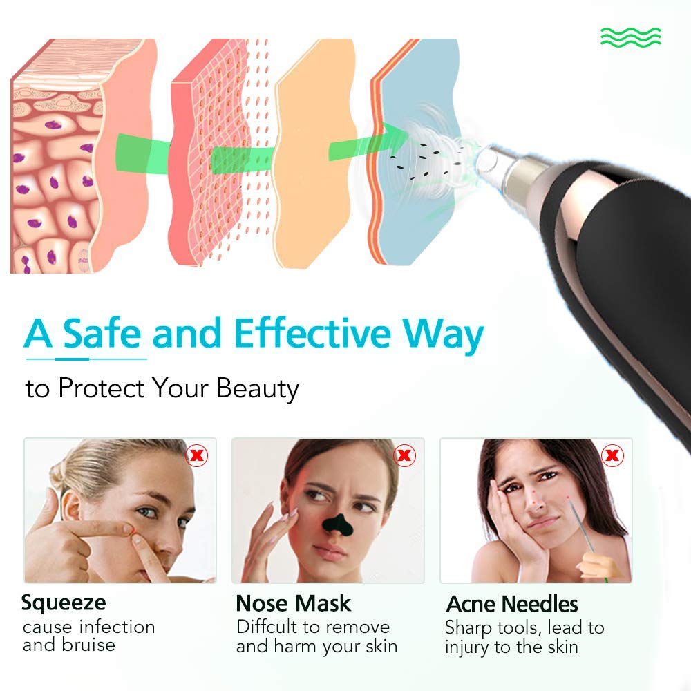 Blackhead Remover Pore Vacuum Cleaner Blackhead and Comedone Acne Extractors Suction Facial Cleaner Electric Blackhead Removal Suction Extractor Tools