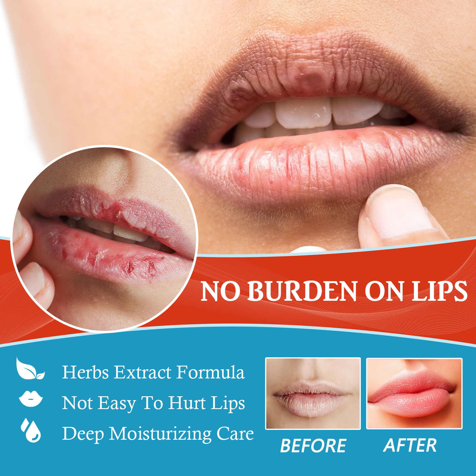 Cheilitis Treatment Cream Lip Cream Cheilitis Type Dressing Moisturizing Brightening Wrinkles Reducing Lip Repairing Cream