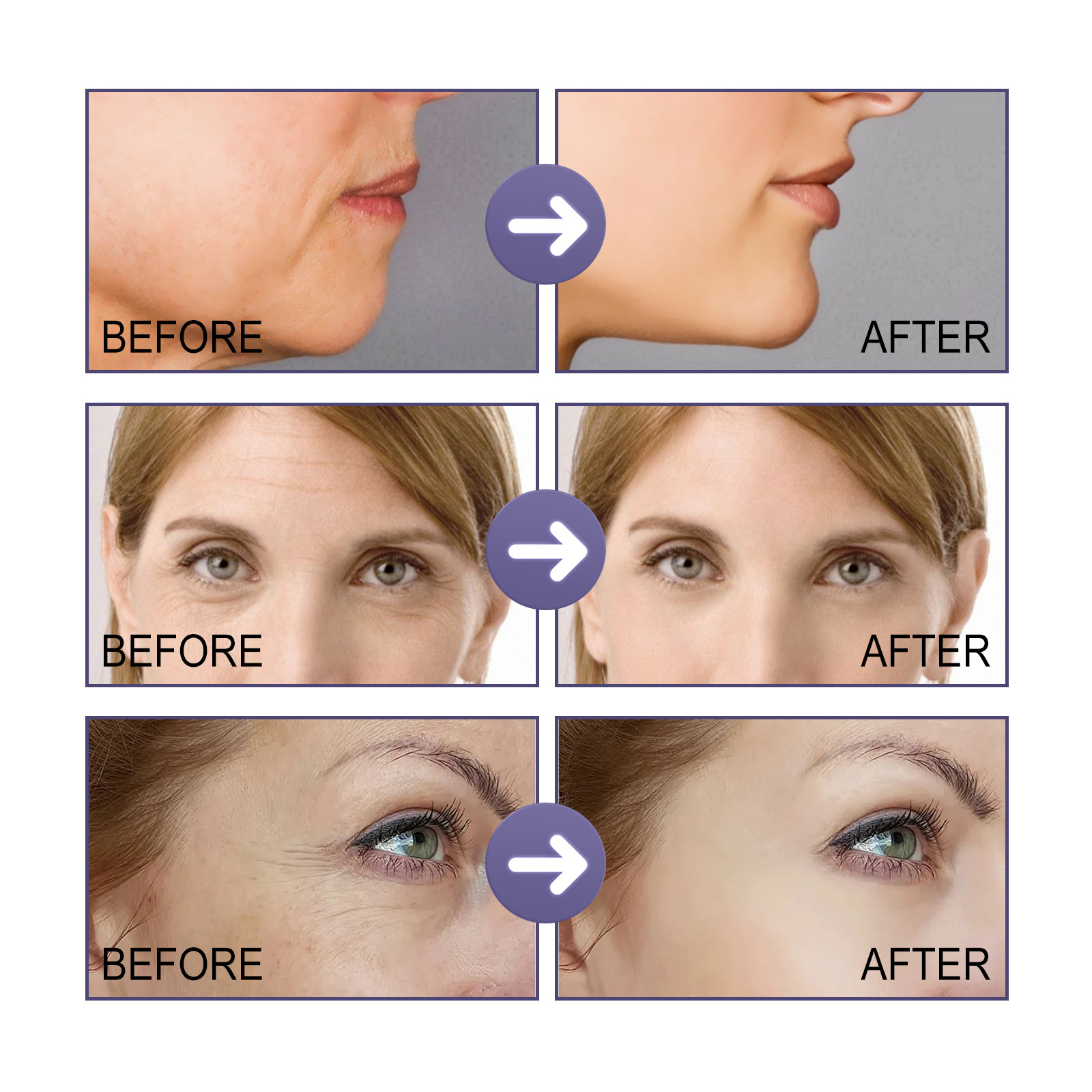 Face Cream Anti Wrinkle Face Brightening Tightening Acne Dark Spot Remover Moisturizing Skin Care Products