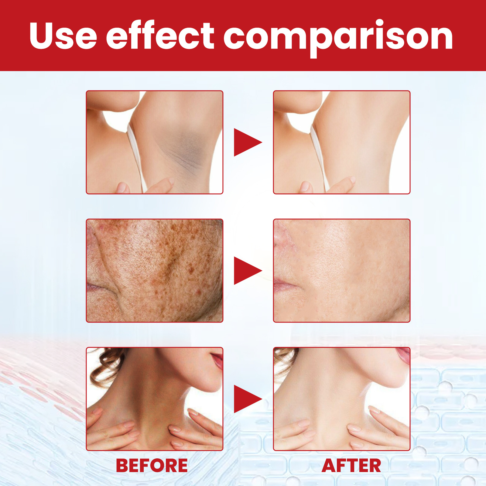 Dark Spot Repair Cream Moisturizer Anti-dark Spot Fine Lines Pigment Remover Cream Whitening Brighten Moisturizing