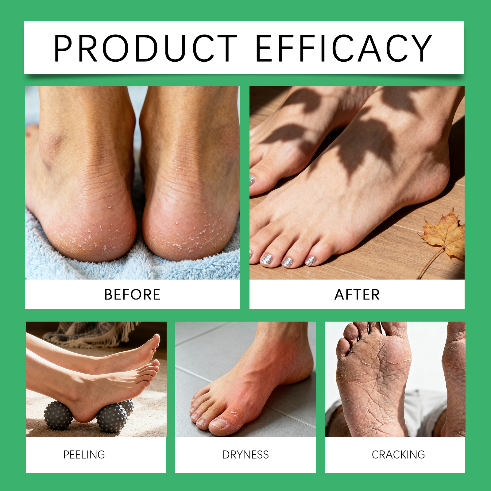 Foot Protection Balm Daily Moisturizing Hydrating Refreshing Comfortable Portable Massage Skin Care For Feet
