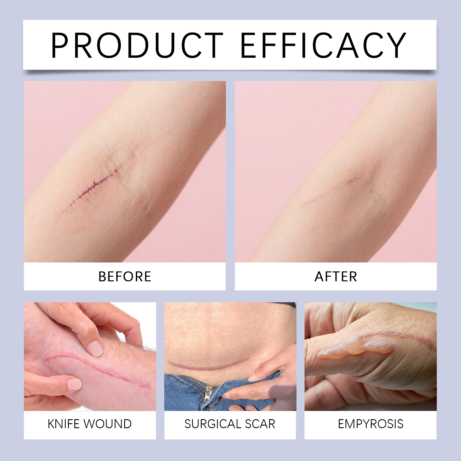 Skin Brightening Gel Mild Formula Lightweight Fast Absorbing Soft Moist Smooth Daily Skin Care