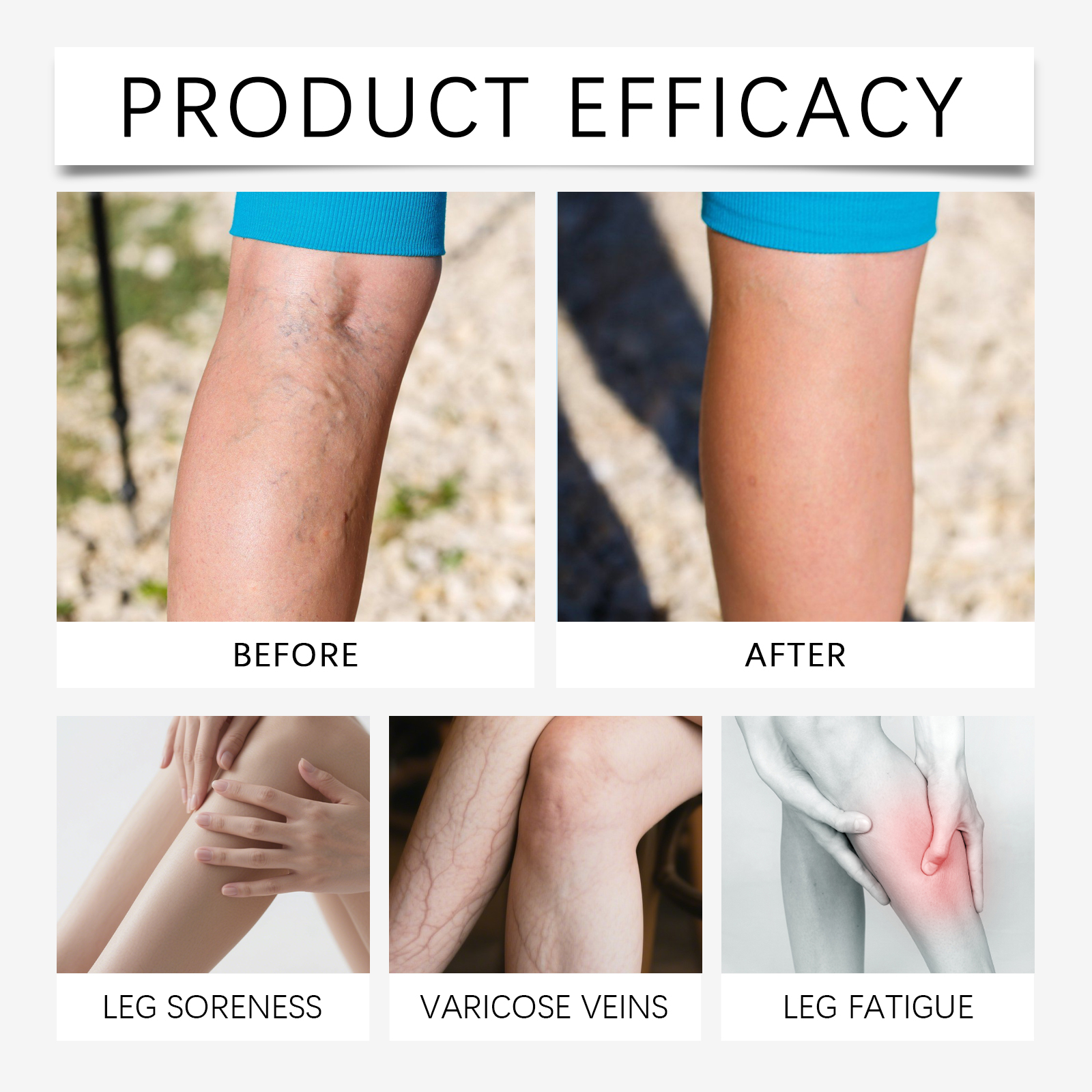 Leg Care Patch Plant Essence Infused Light Fit Easy Apply Daily Calf Dry Rough Skin Soften