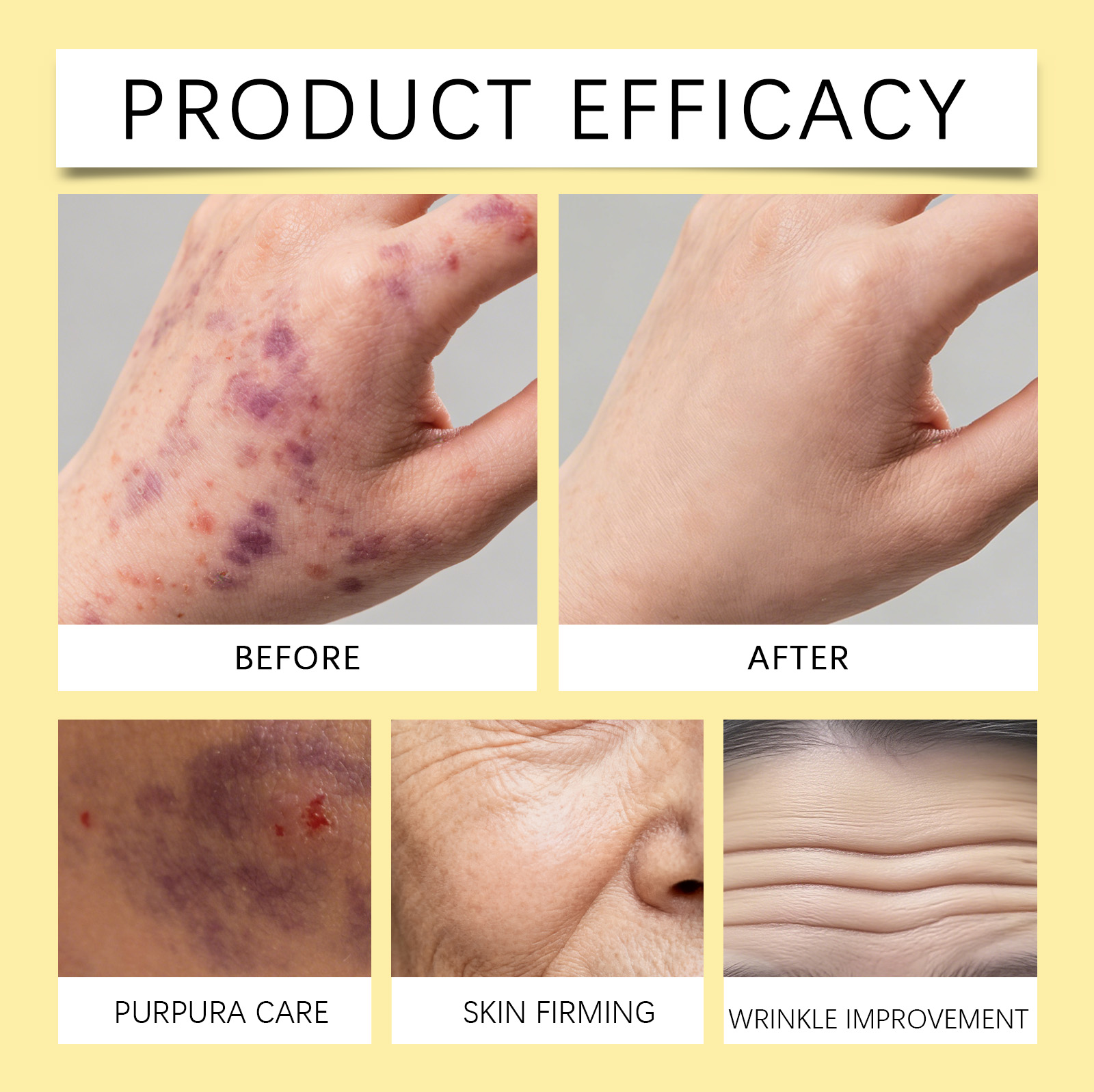Bee Venom Moisturizing Cream Mild Soft Care Skin Delicate Texture Nourish Hydrate Easy Smear Skin Essence