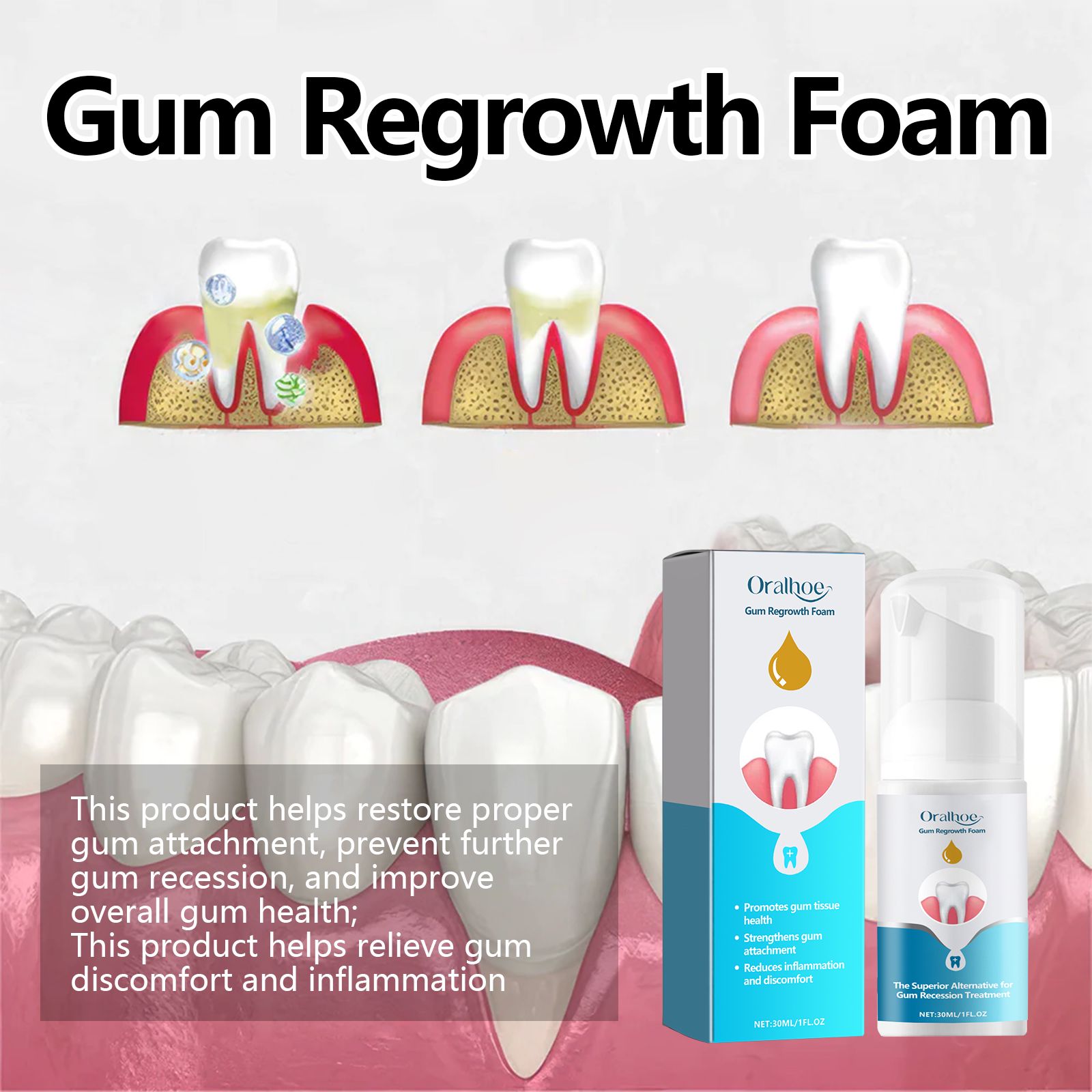 Gum Care Foam Mousse For Teeth Cleaning Plaque Removal And Fresh Breath Daily Oral Hygiene
