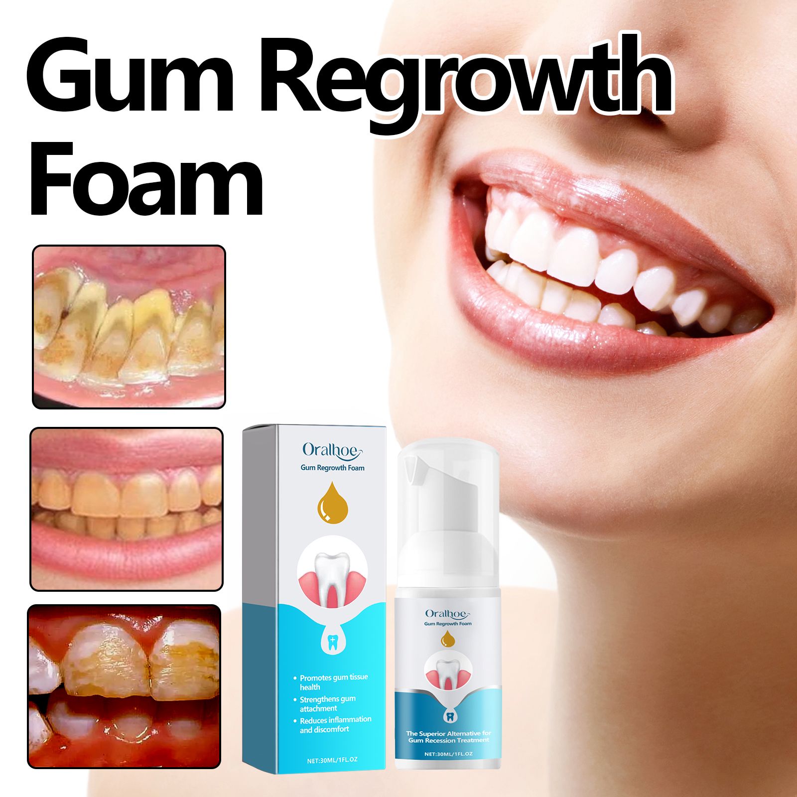 Gum Care Foam Mousse For Teeth Cleaning Plaque Removal And Fresh Breath Daily Oral Hygiene
