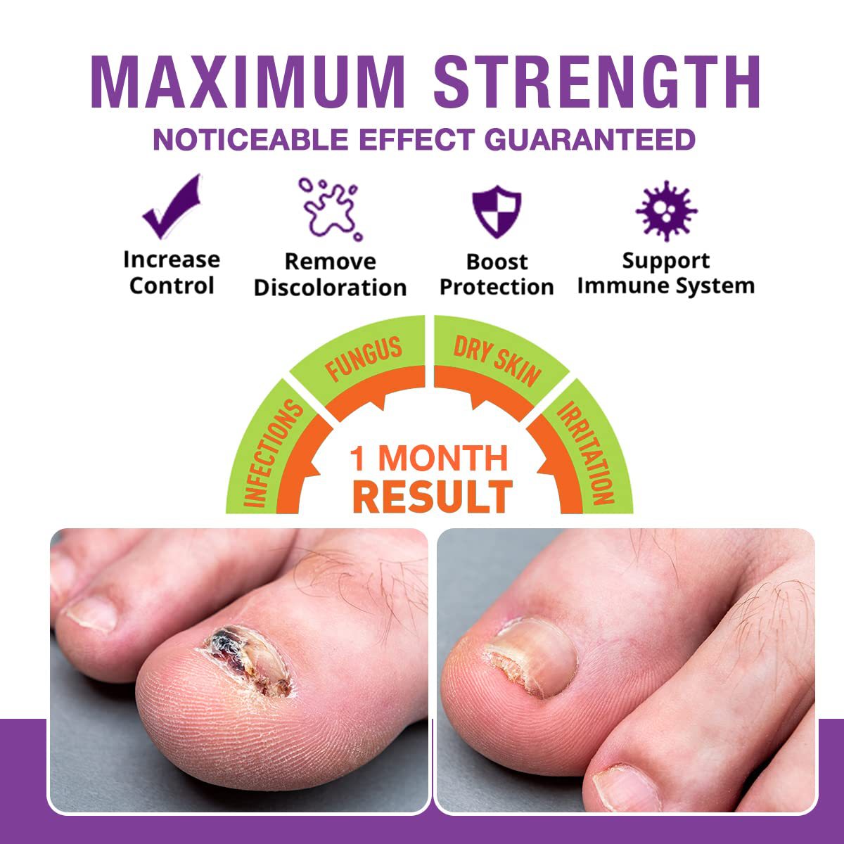 iBeaLee Nail Fungus Treatment Onychomycosis Repair Liquid Anti-Infective Oil Essence Serum Hand And Foot Care Supplies for Men Women 20ml