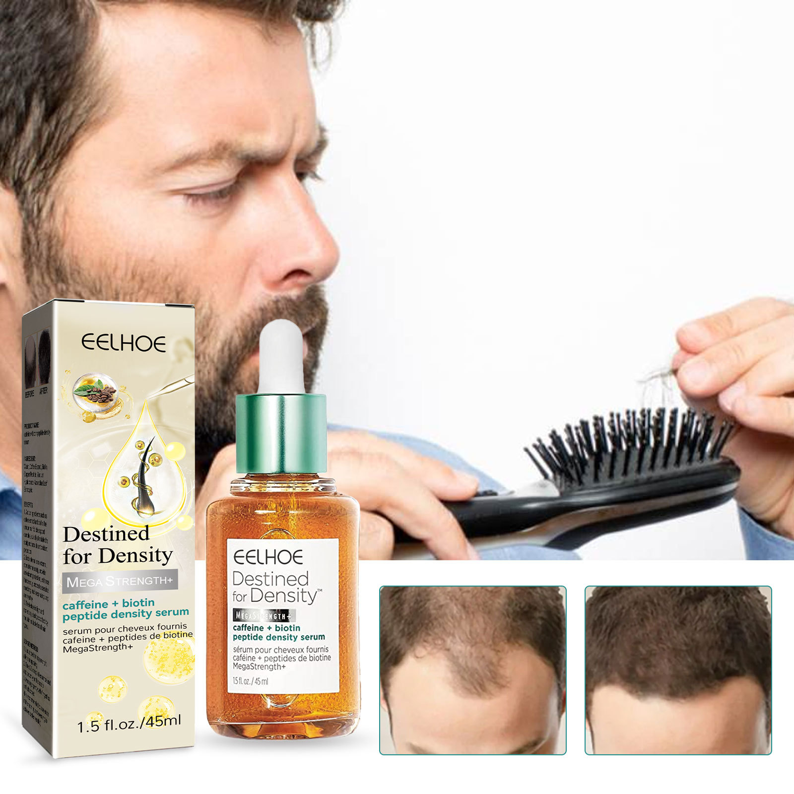Hair Growth Essential Oil Hair Growth Oil for  Hair Fixing And Density Increasin Strong Hair Stop Thinning and Hair Loss