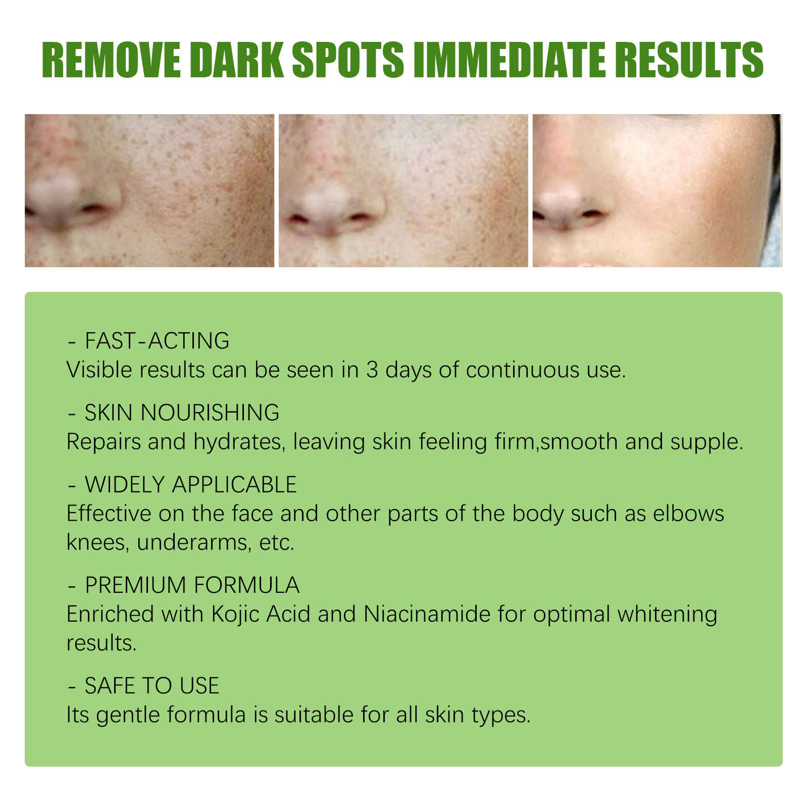 Whitening Freckles Cream Face Remove Melasma Dark Spots Lighten Melanin Melasma Remover Moisturizing Brighten Skin Care 30ml