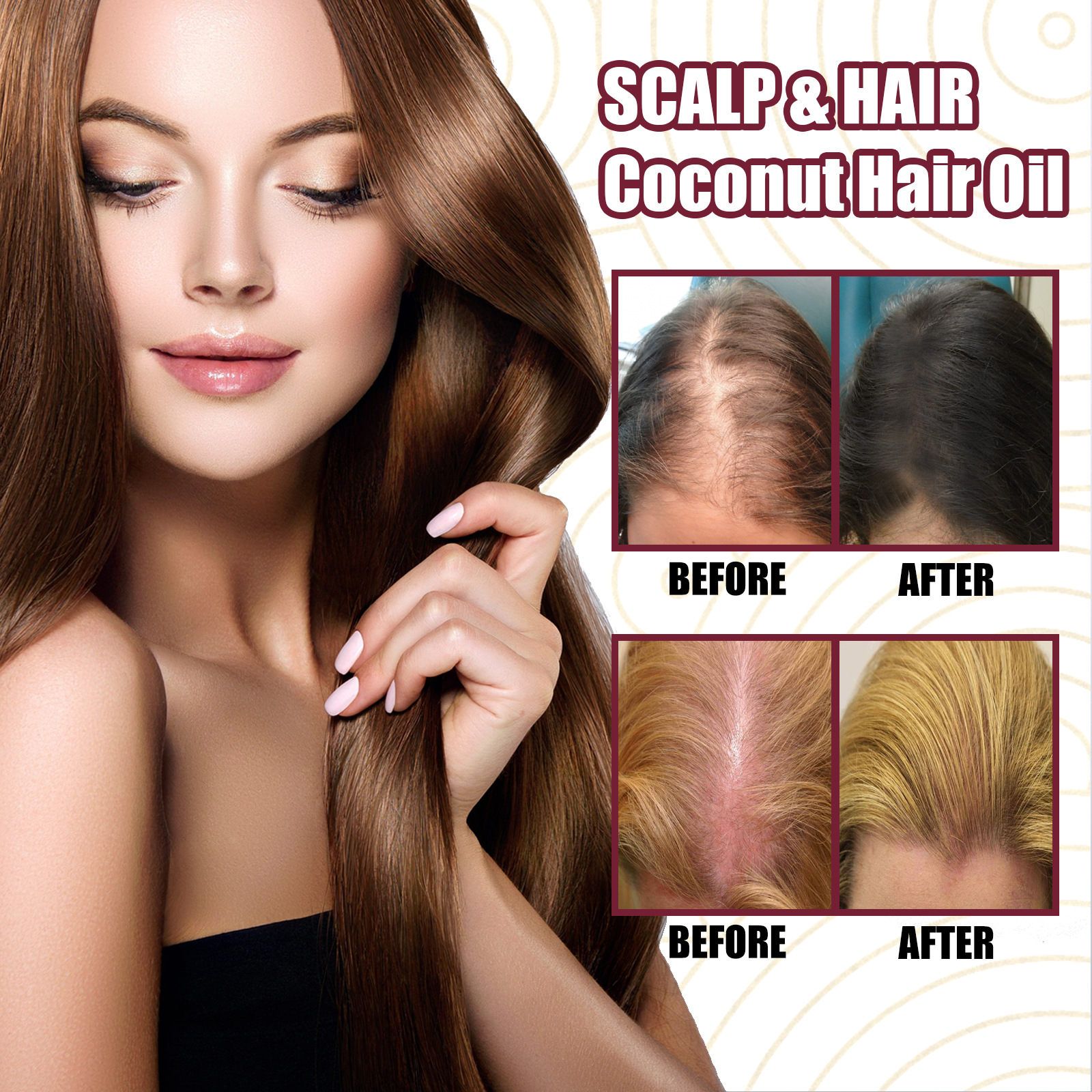 Onion Hair Thickening Spray Hair Anti-Loss Spray For Improving Scalp Circulation Stimulating Hair Growth Strengthening Home Use 30ml