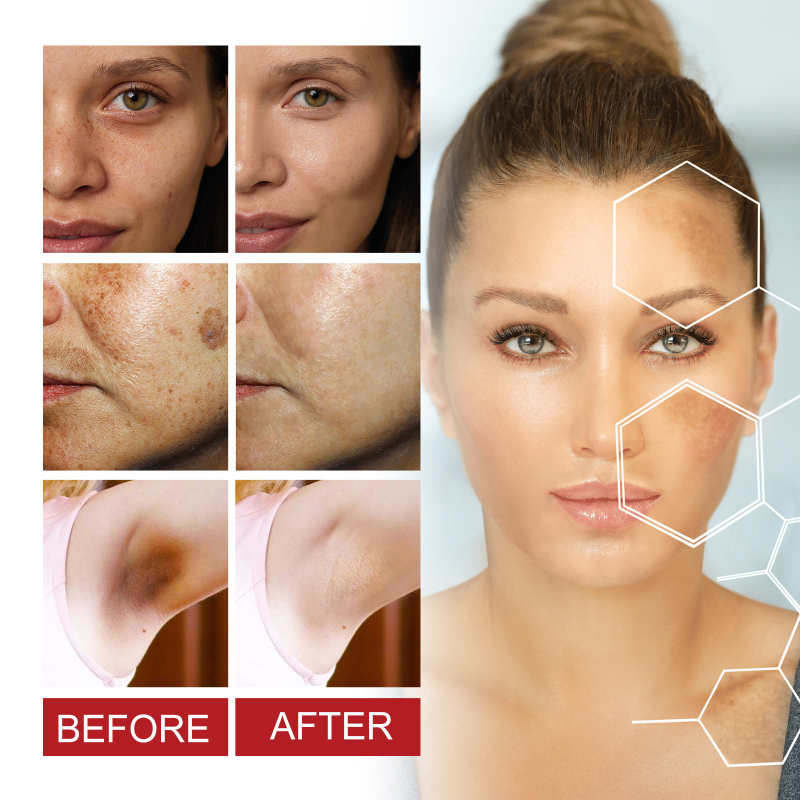 Dark Spots Corrector Anti Dark Spot Cream Whitening Facial Cream Repair Fade Freckles Melanin Remover Brighten Moisturizing Improving Facial Dullnes