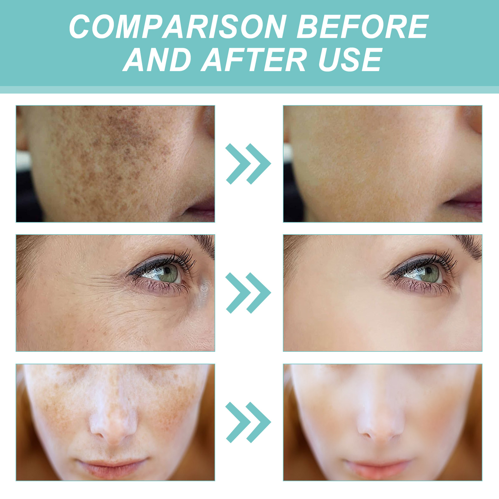 (1 PC) Whitening Freckle Cream Removing Black Spots Melanin Freckle Anti-Aging Brighten Skin Shrink Pores Powerful Moisturizing Cream