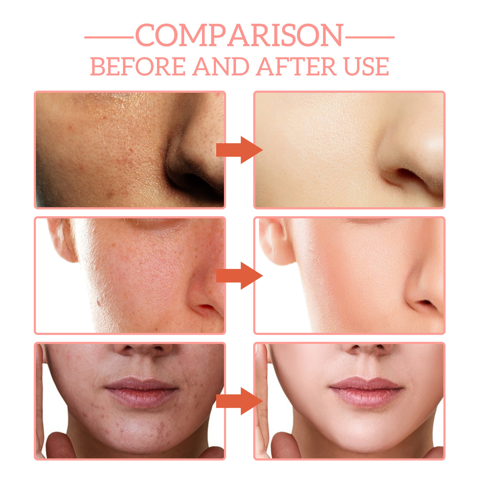 Jaysuing 5 In 1 Facial Serum Fade Fine Lines Firming Skin Shrink Pores Moisturizing Hyaluronic Acid Face Serum