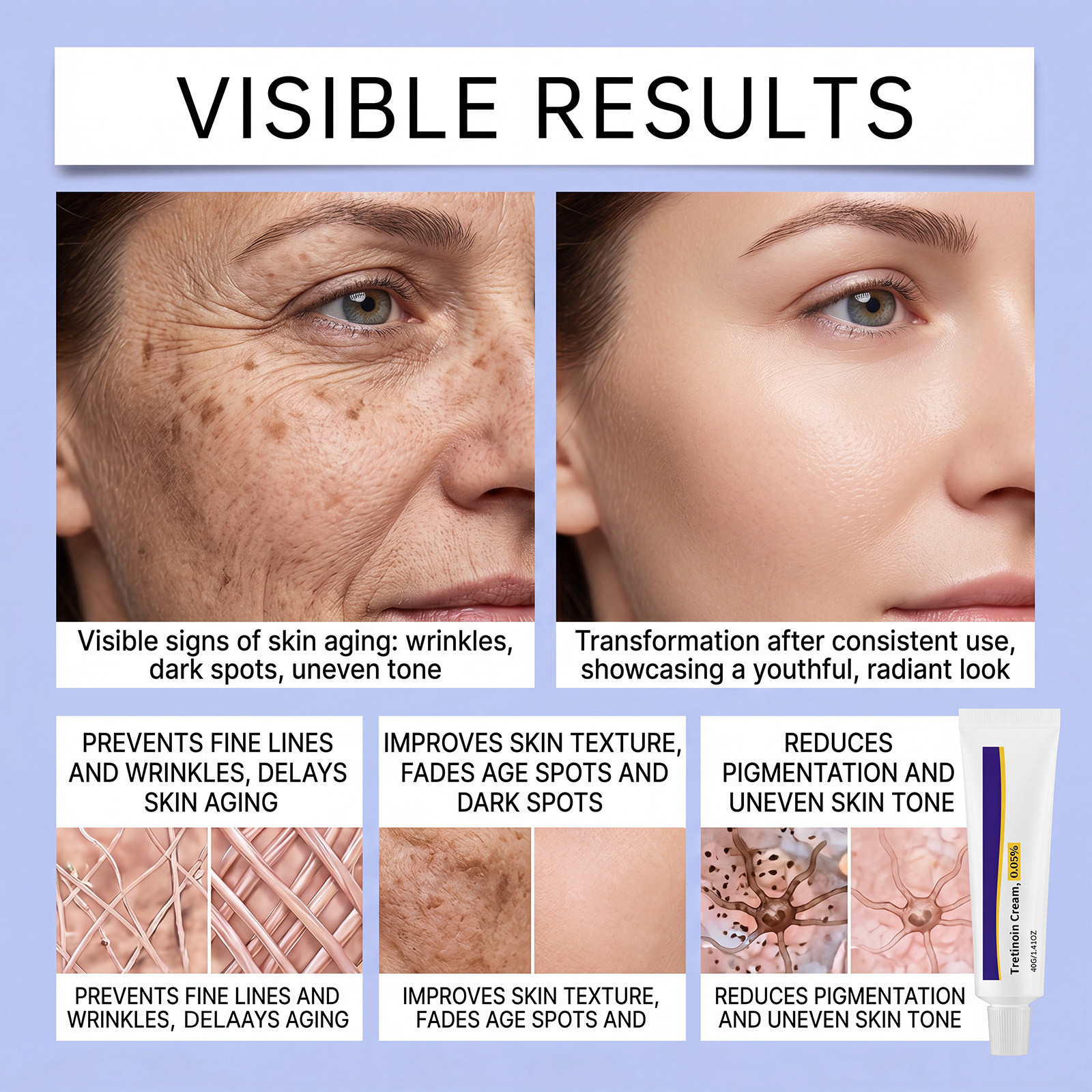 Tretinoin Care Cream Cleanses Hydrates Skin Soft Smooth Even Tone Fast Absorb Daily Skin Treatment