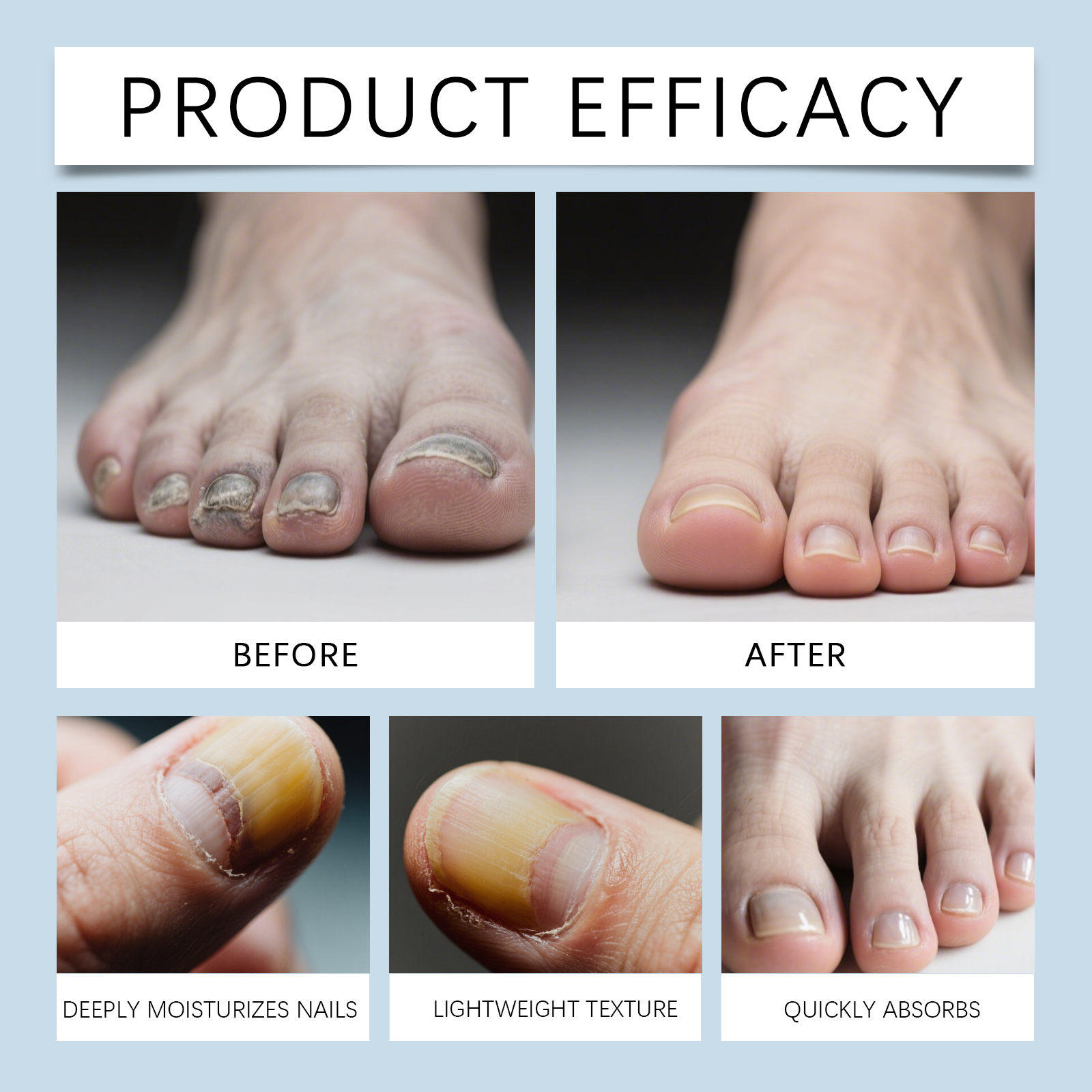 Nail Nourishing Pen Mild Ingredients Care Nourish Hand Foot Nails Soft Smooth Natural Gloss Daily Maintenance